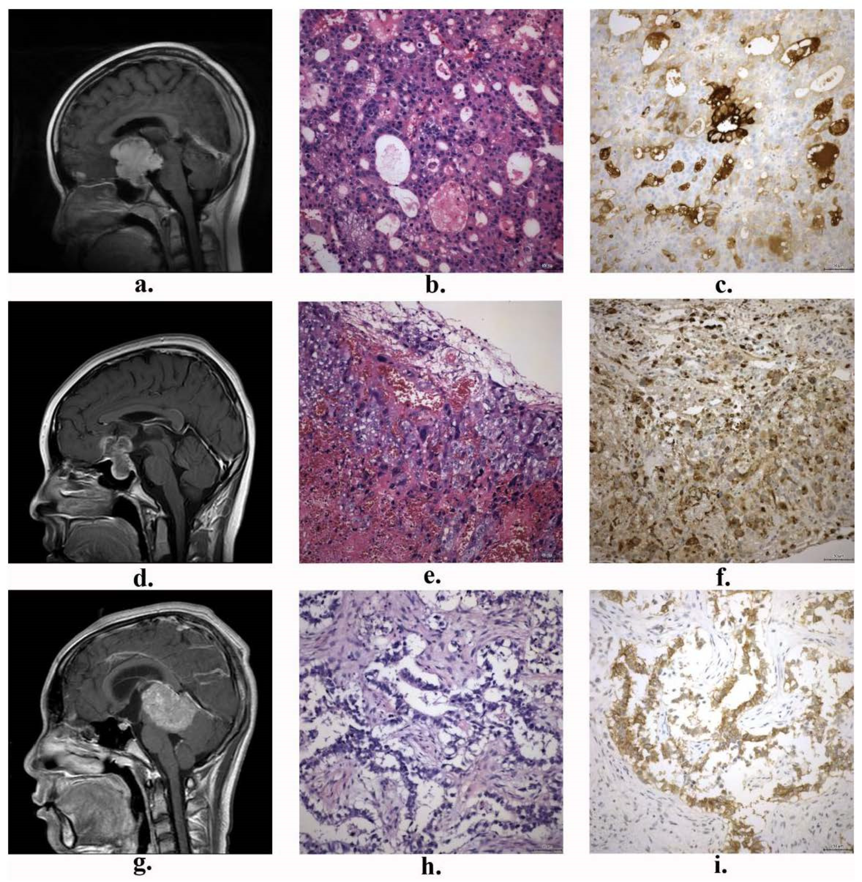 Brainsci 14 00445 g002