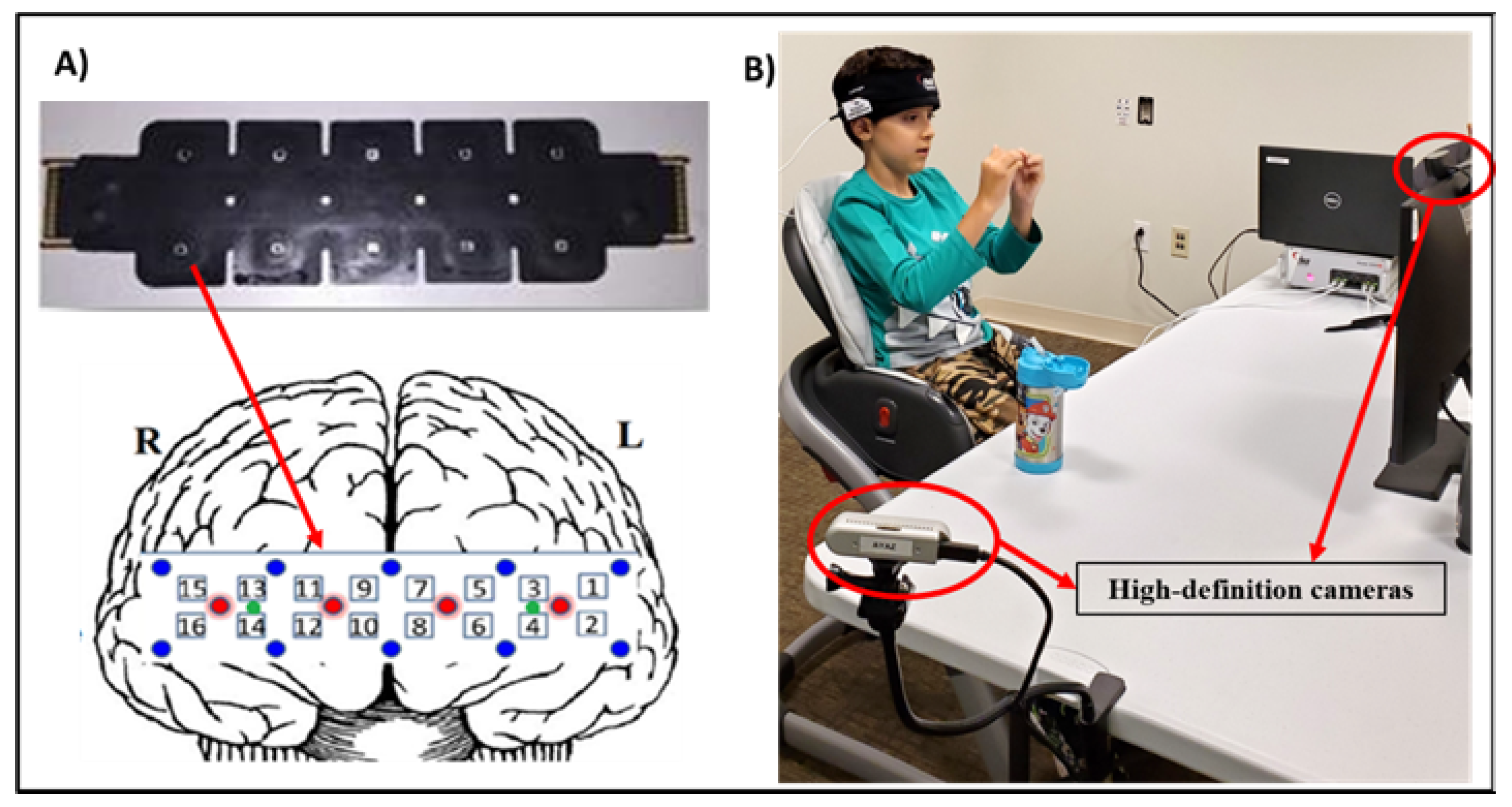 Brainsci 14 00503 g001