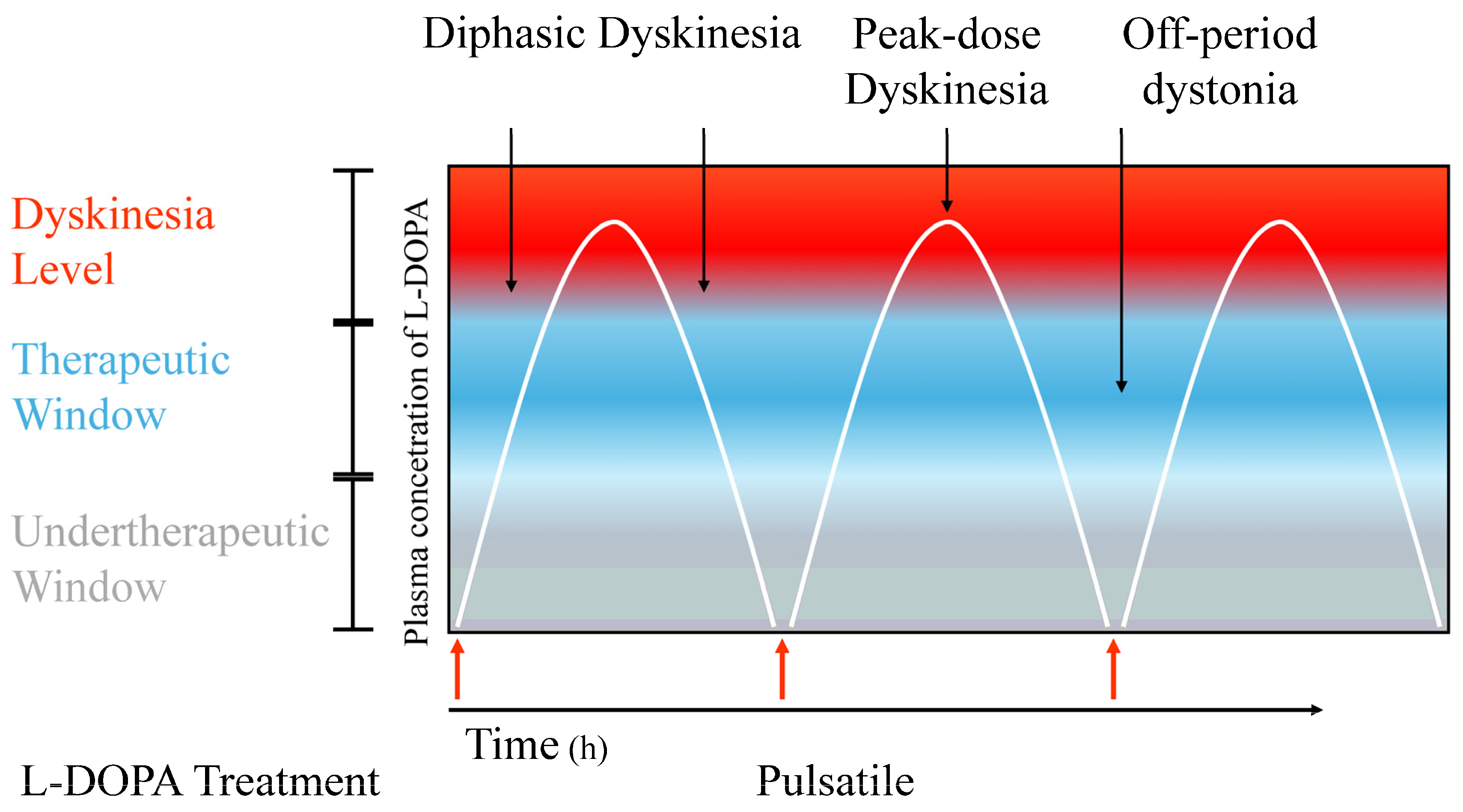 Neuroinflammation and Dyskinesia: A Possible Causative Relationship?