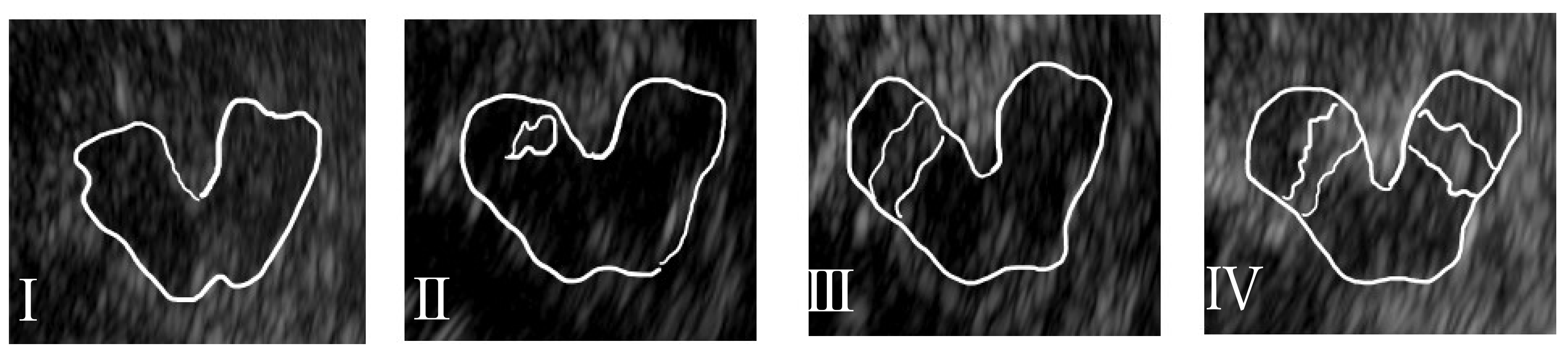 Brainsci 14 00524 g001