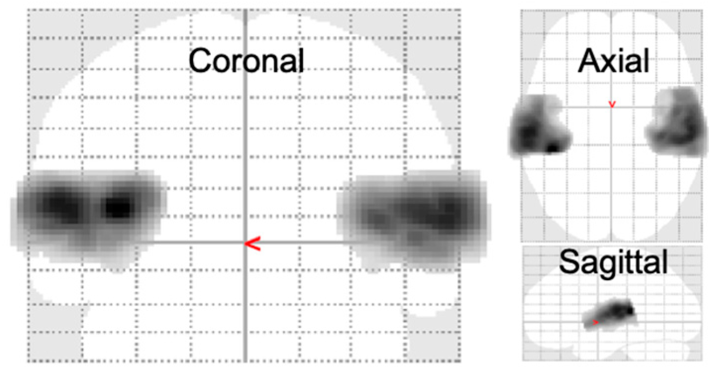 Brainsci 14 00544 g003