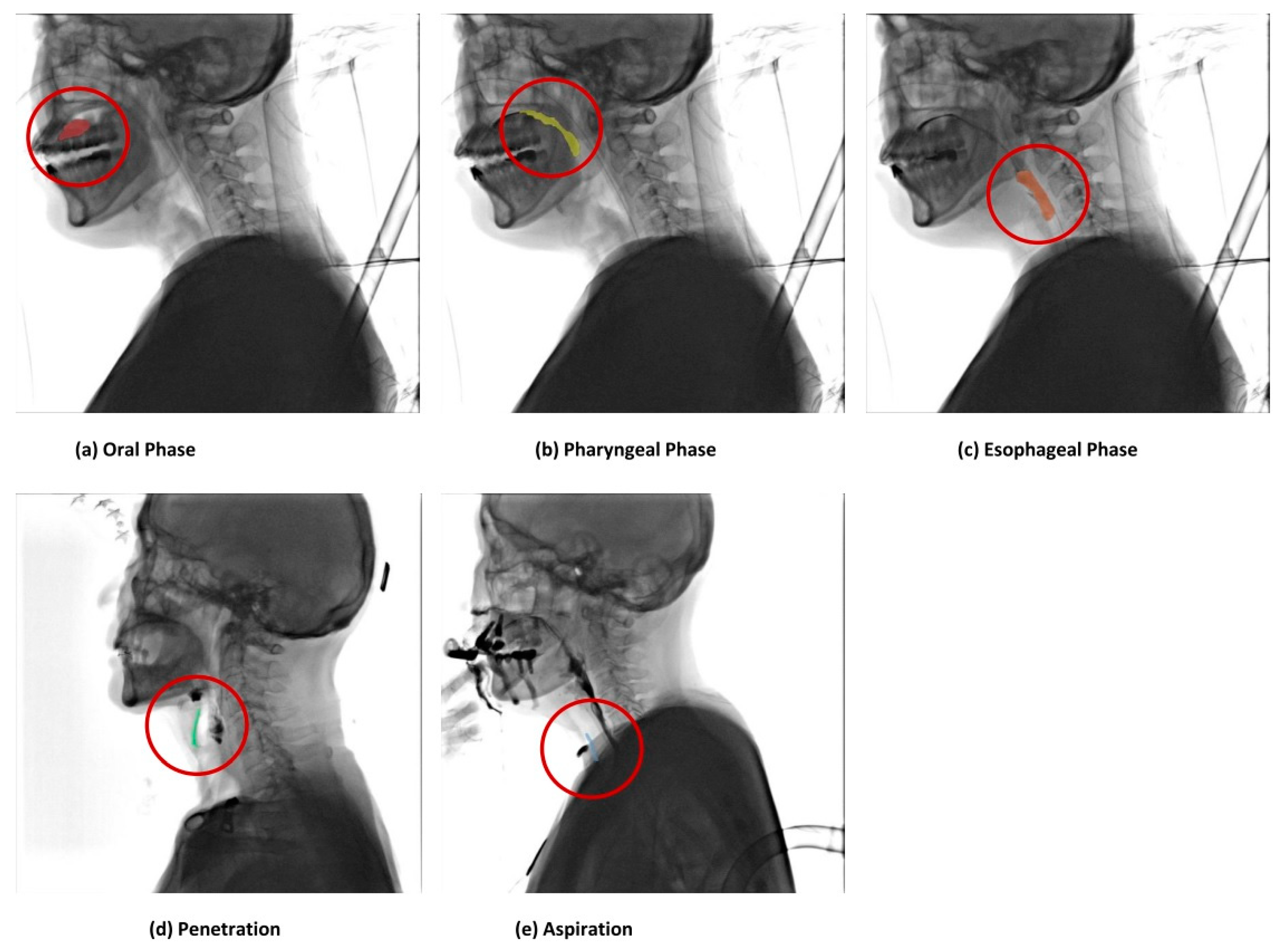 Brainsci 14 00546 g005