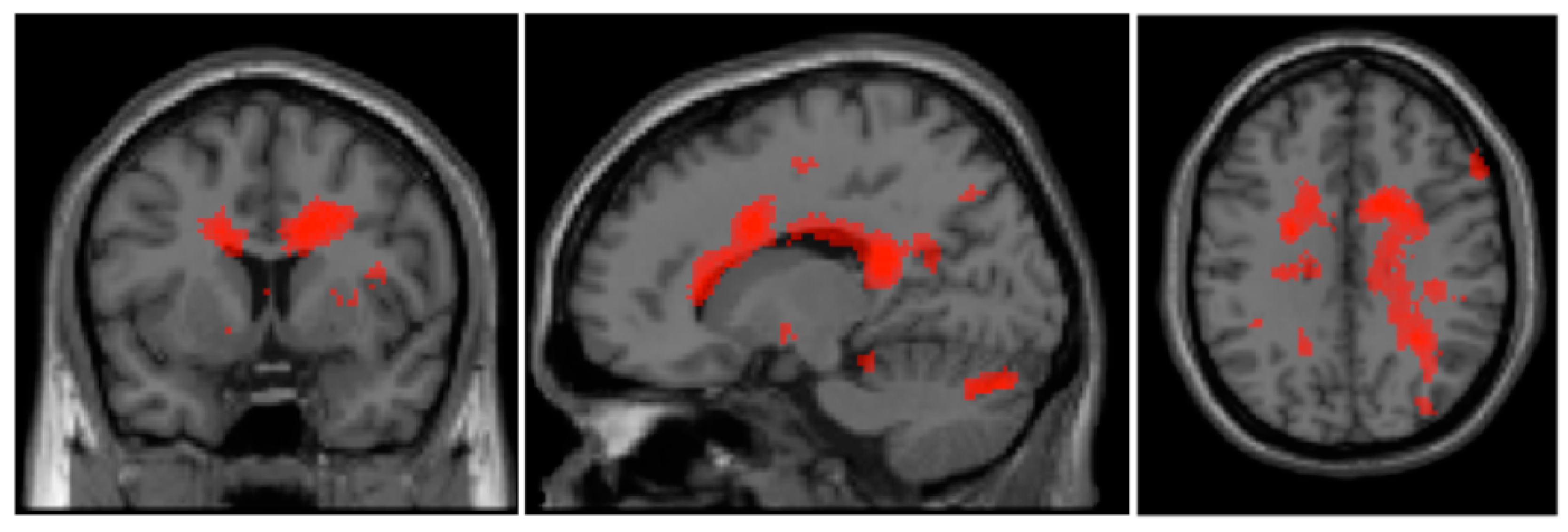 Brainsci 14 00549 g002