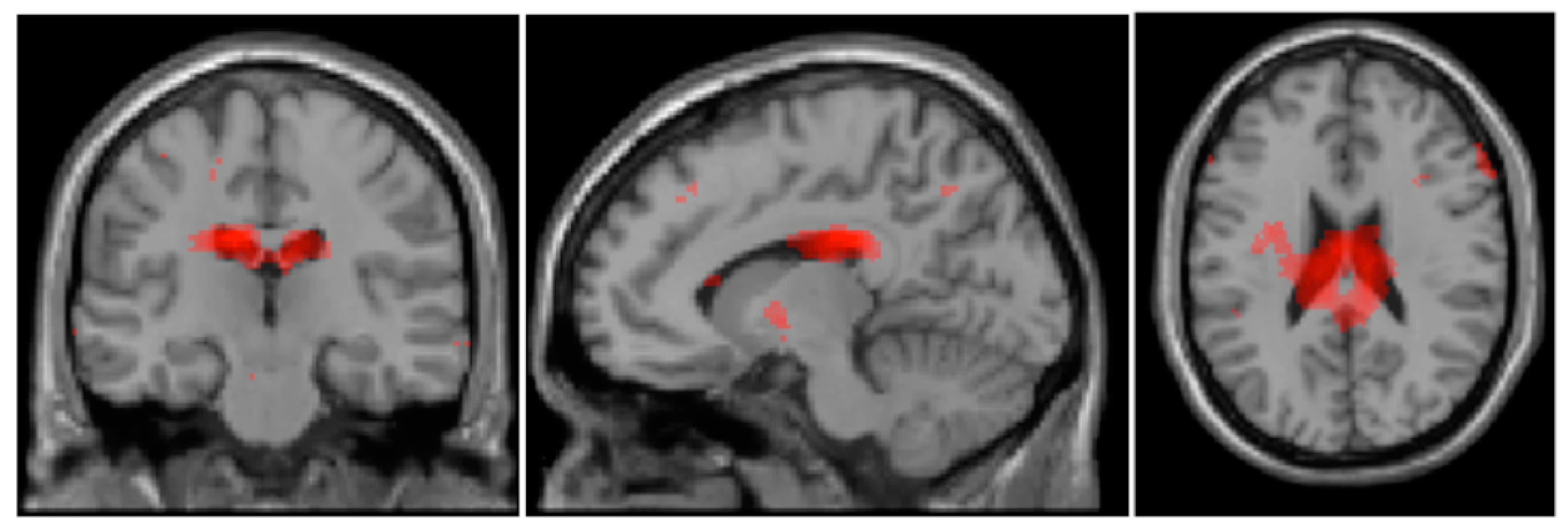 Brainsci 14 00549 g003