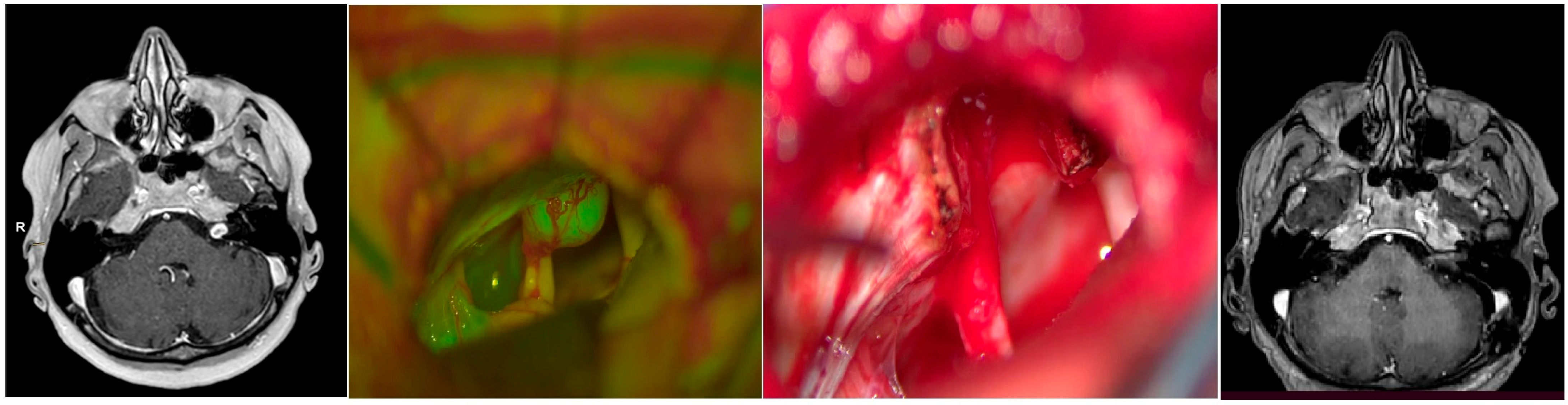 Brainsci 14 00571 g002