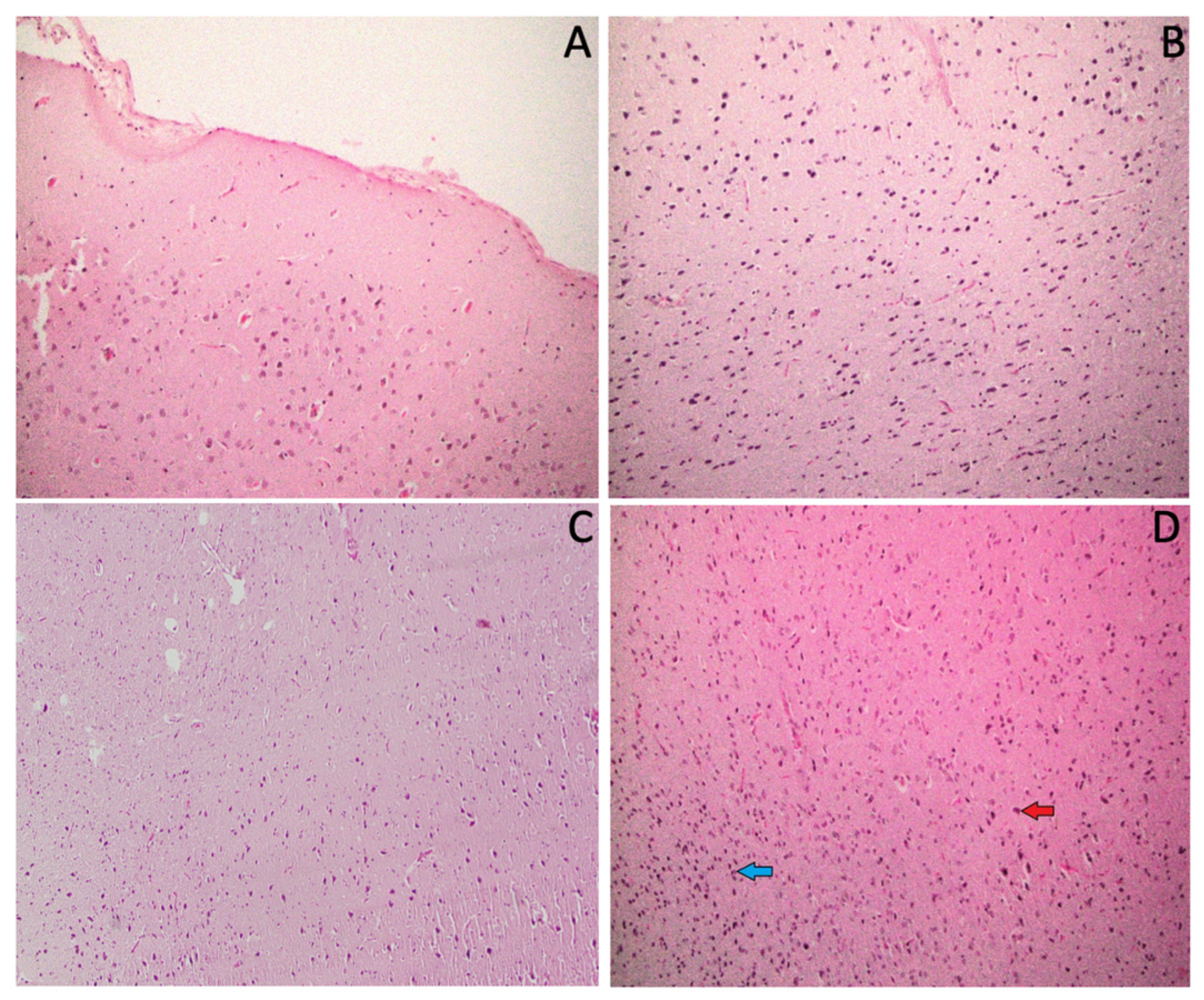 Brainsci 14 00574 g011 Brainsci 14 00574 g011
