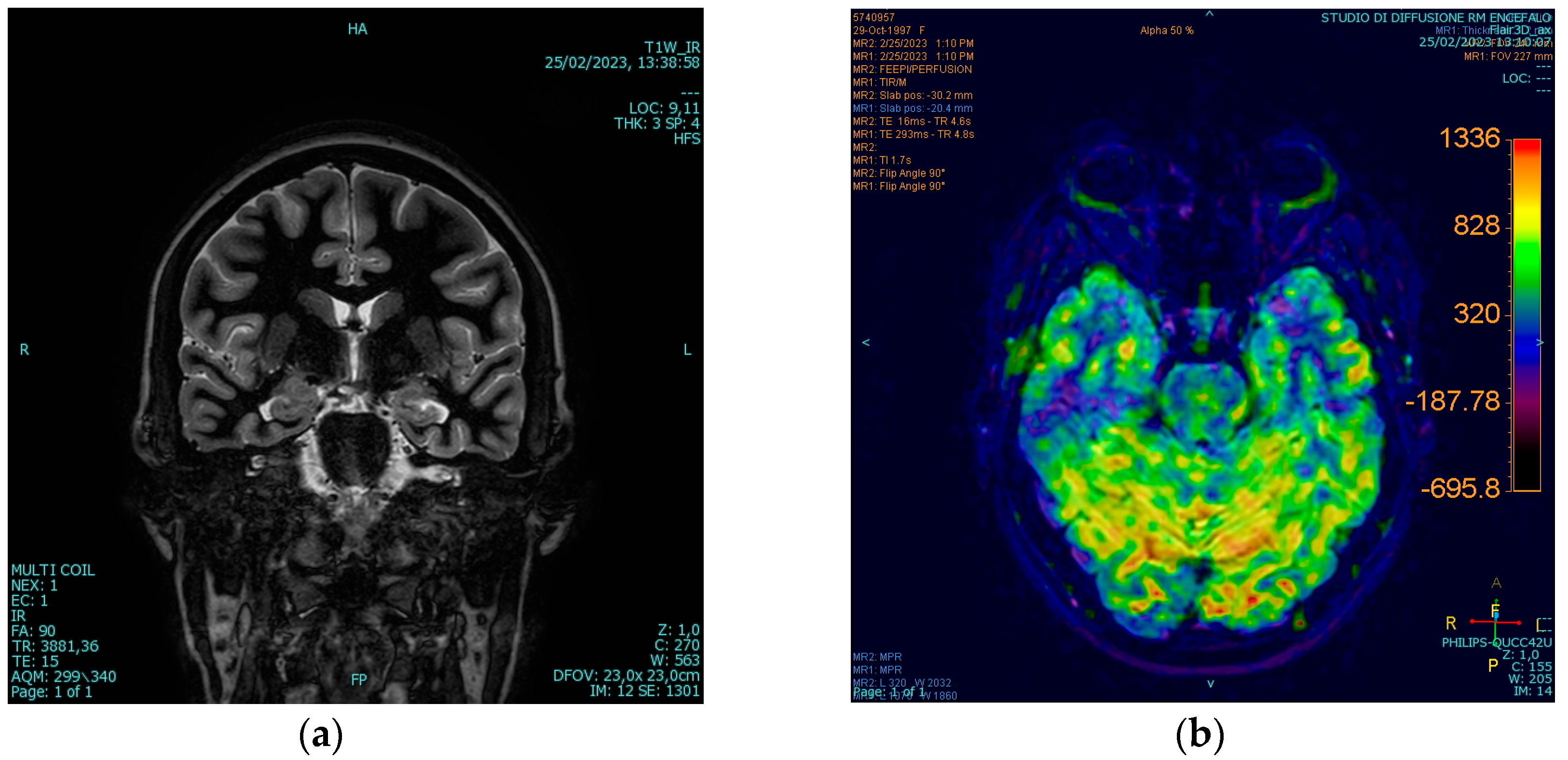 Brainsci 14 00594 g001