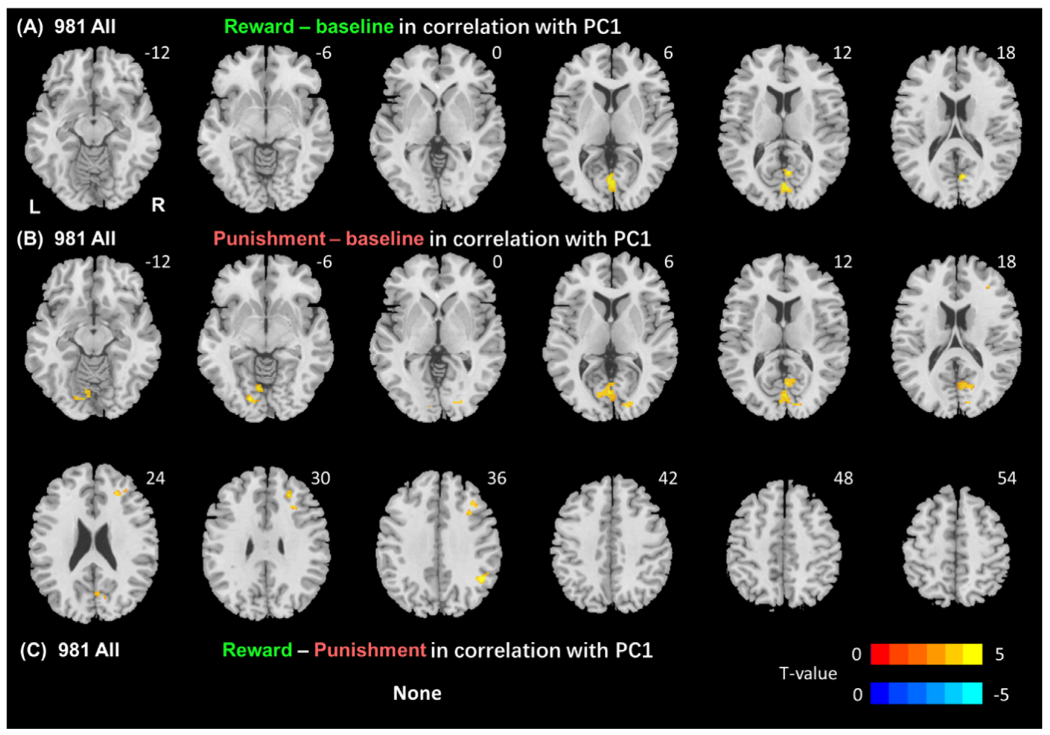 Brainsci 14 00610 g001 Brainsci 14 00610 g001