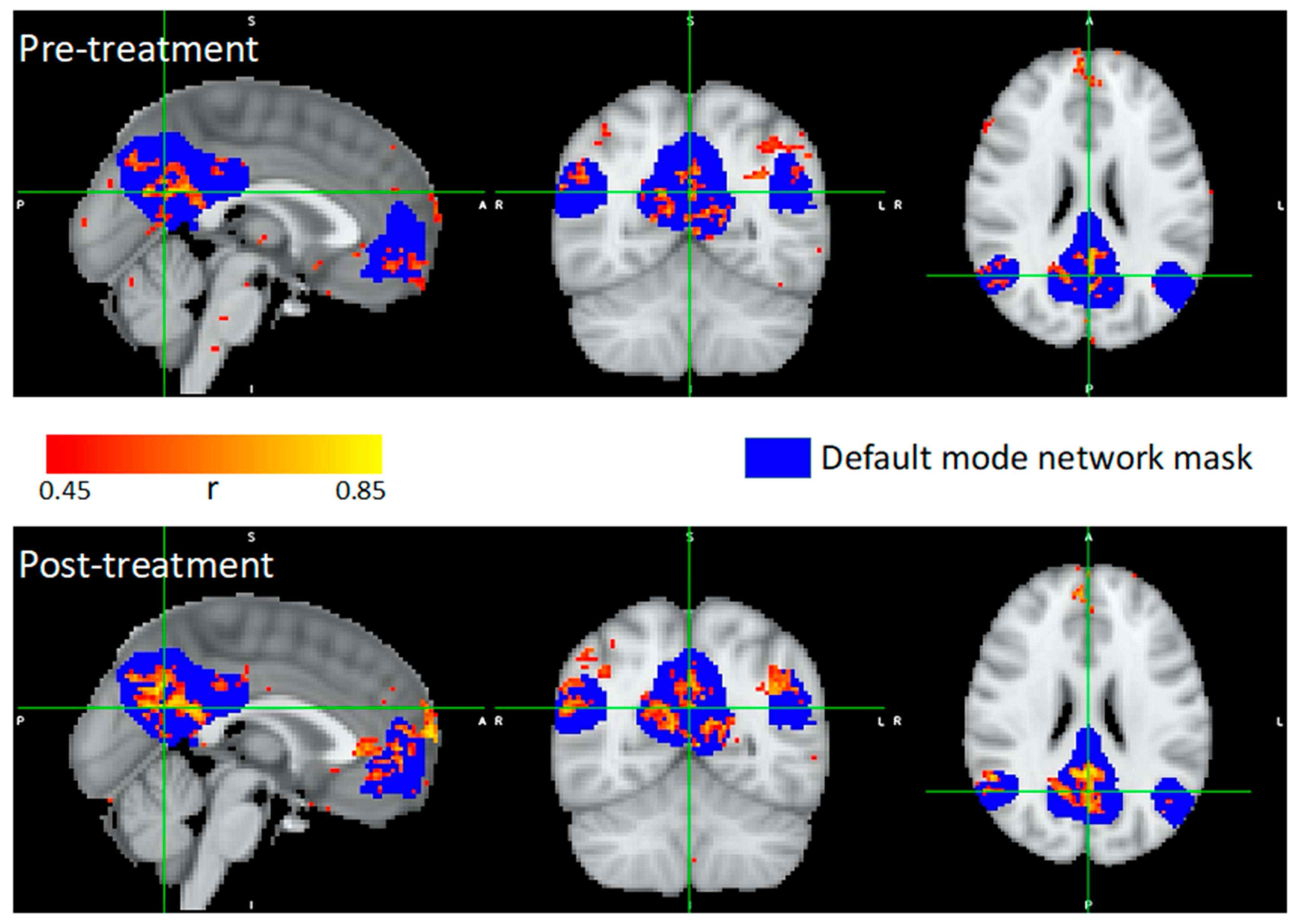 Brainsci 14 00714 g006