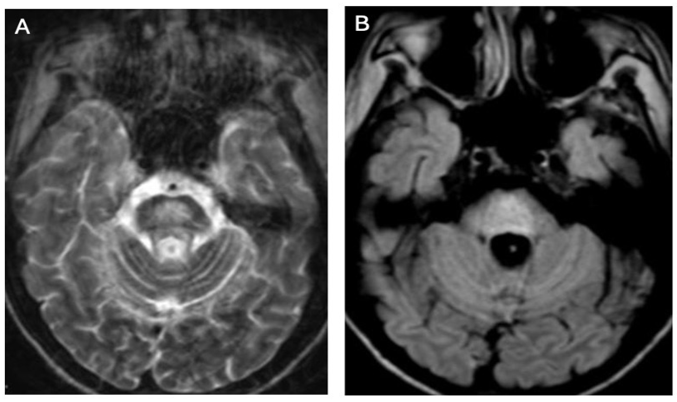 Brainsci 14 00727 g002 Brainsci 14 00727 g002