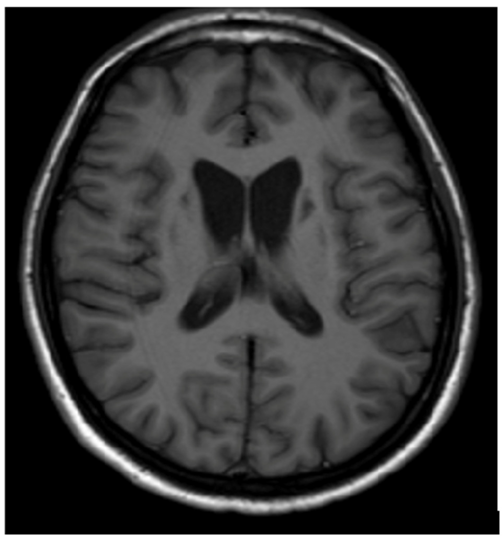 Brainsci 14 00727 g003 Brainsci 14 00727 g003