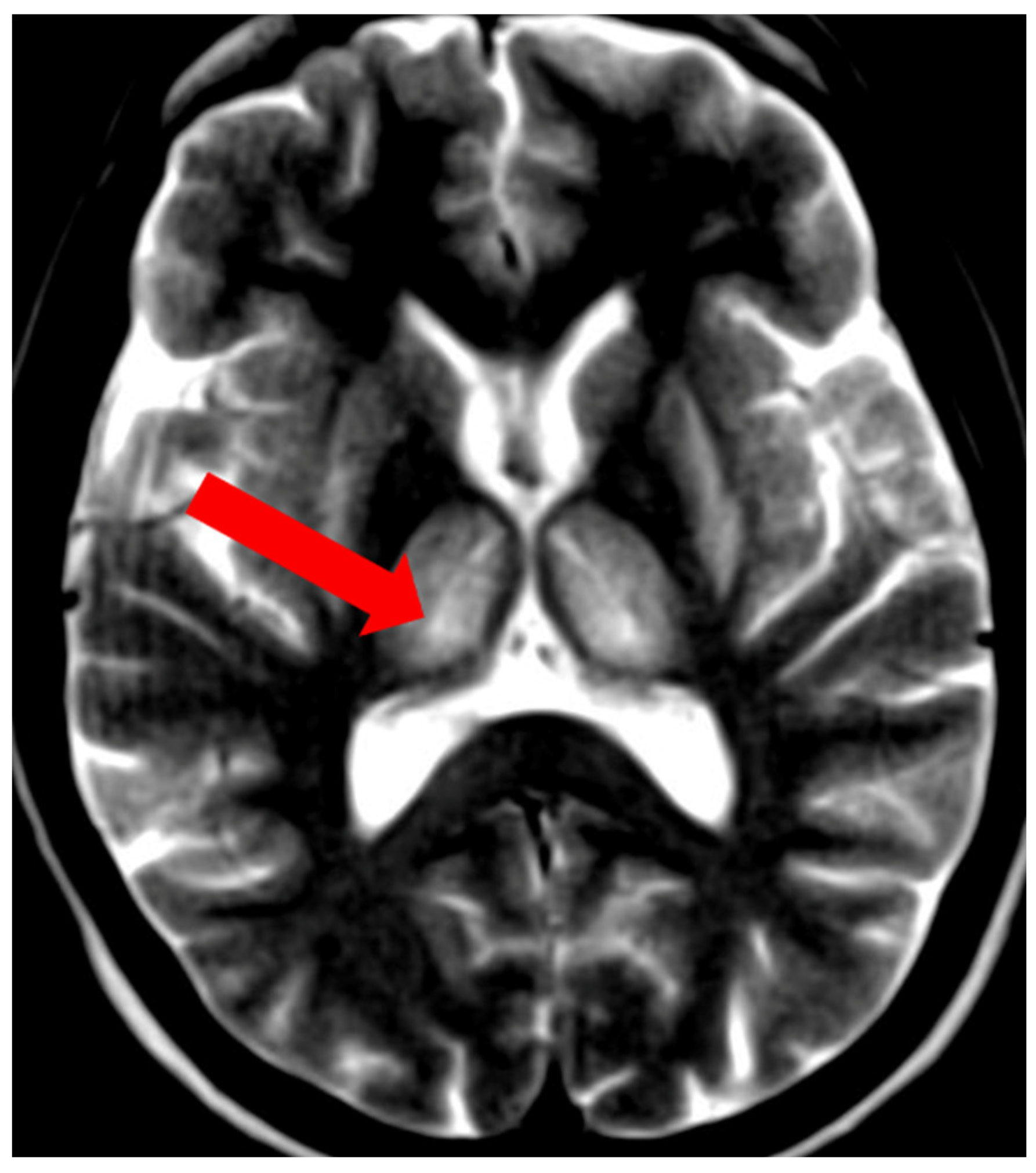 Brainsci 14 00727 g009 Brainsci 14 00727 g009