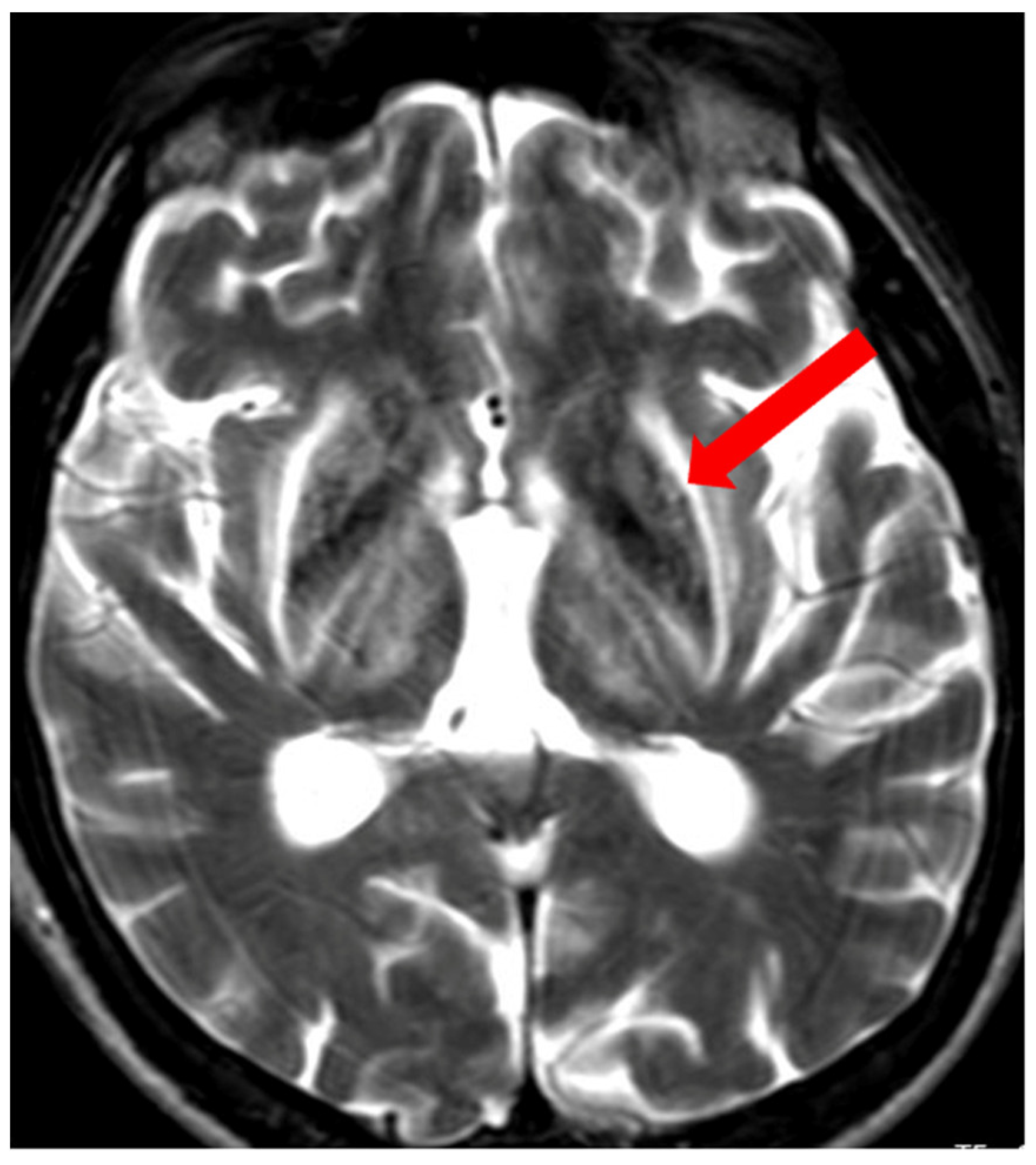 Brainsci 14 00727 g011 Brainsci 14 00727 g011