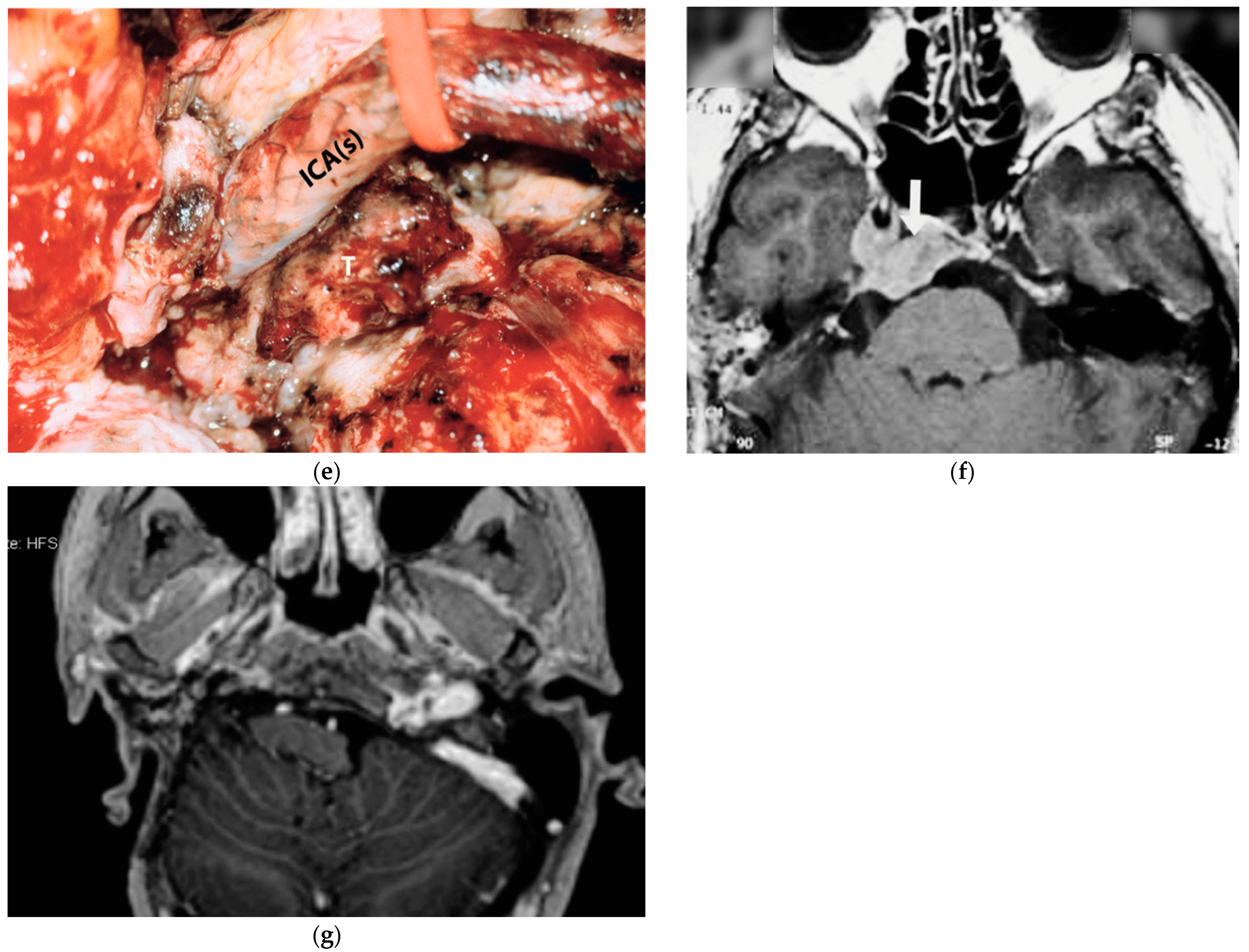 Brainsci 14 00745 g003b