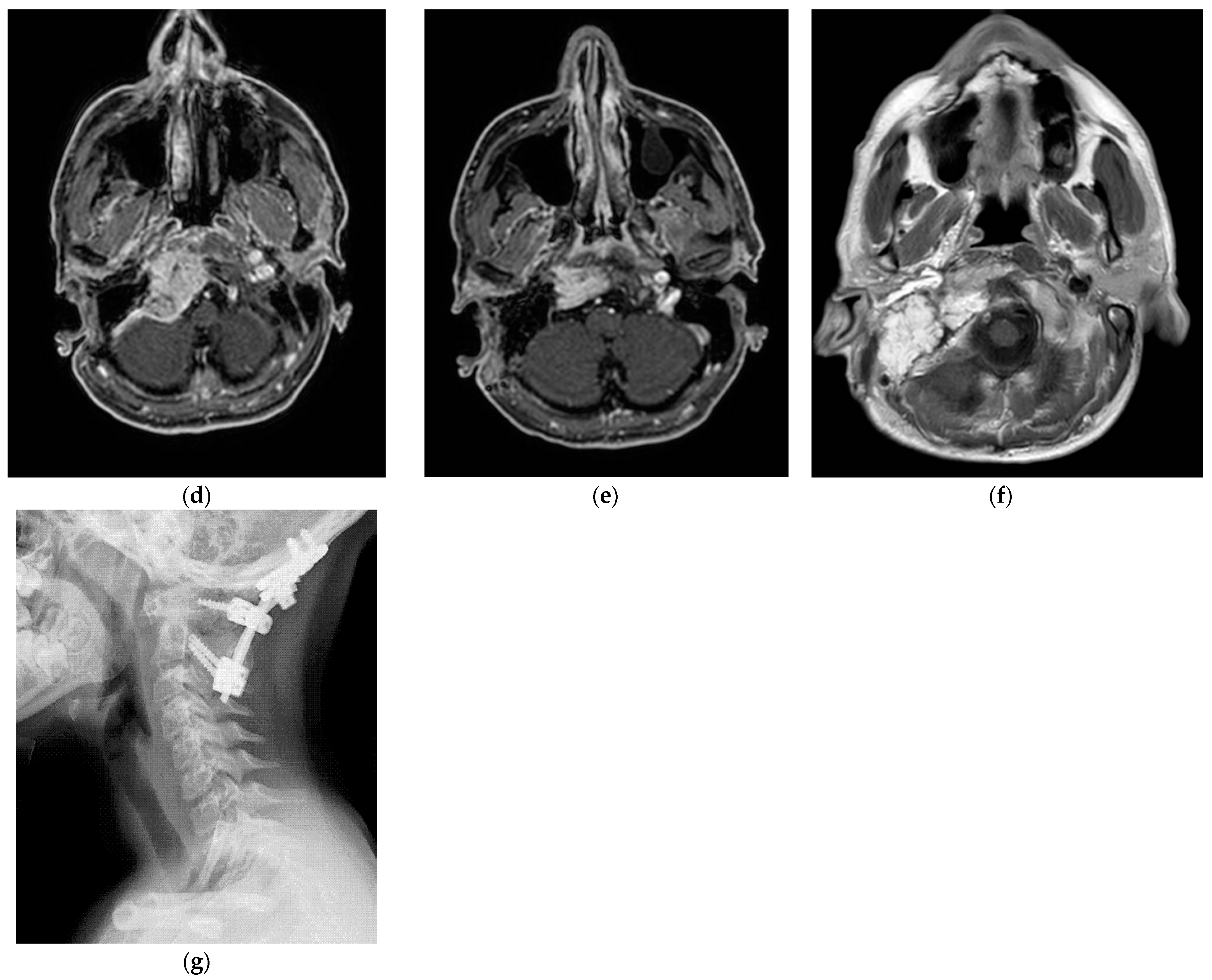 Brainsci 14 00745 g004b