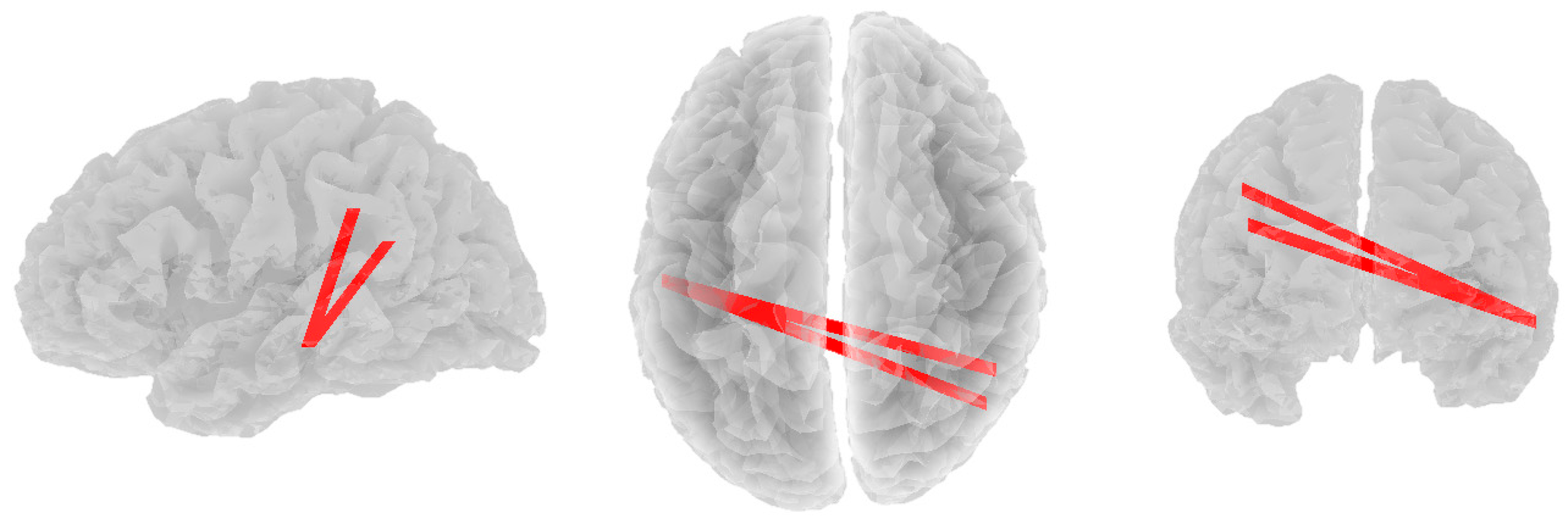 Brainsci 14 00845 g001