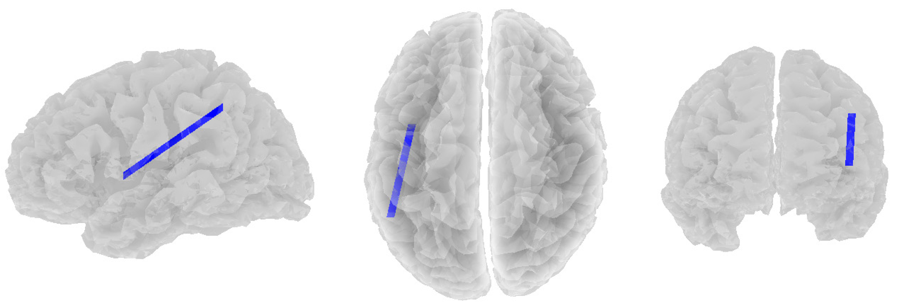 Brainsci 14 00845 g002