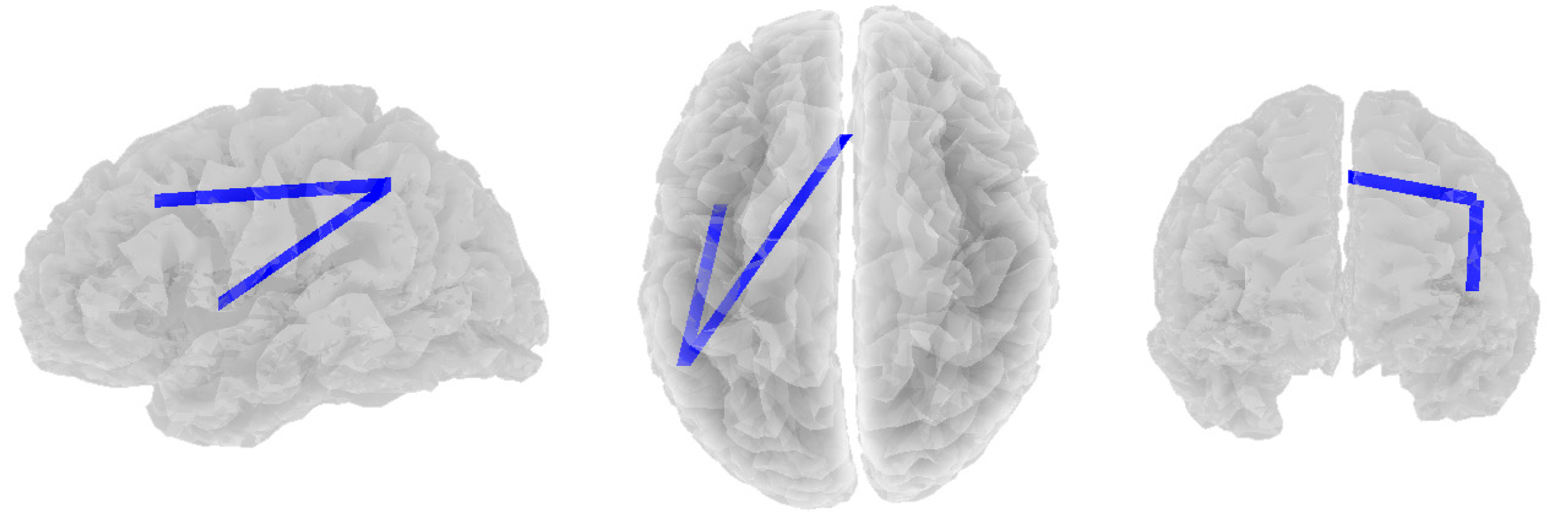 Brainsci 14 00845 g003