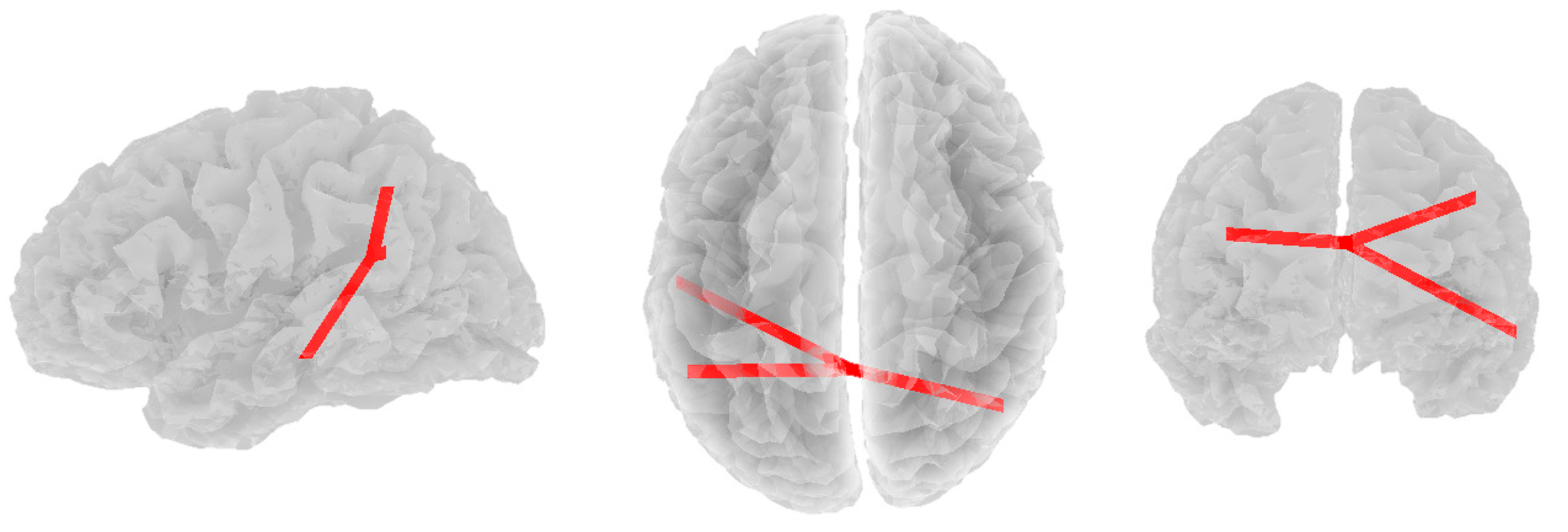 Brainsci 14 00845 g004