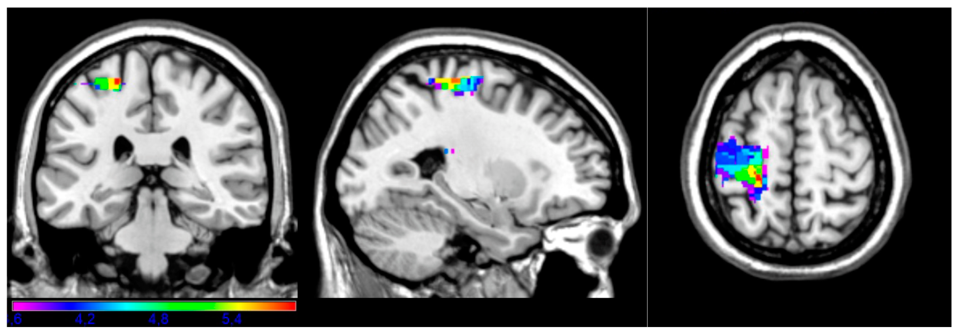Brainsci 14 00853 g002