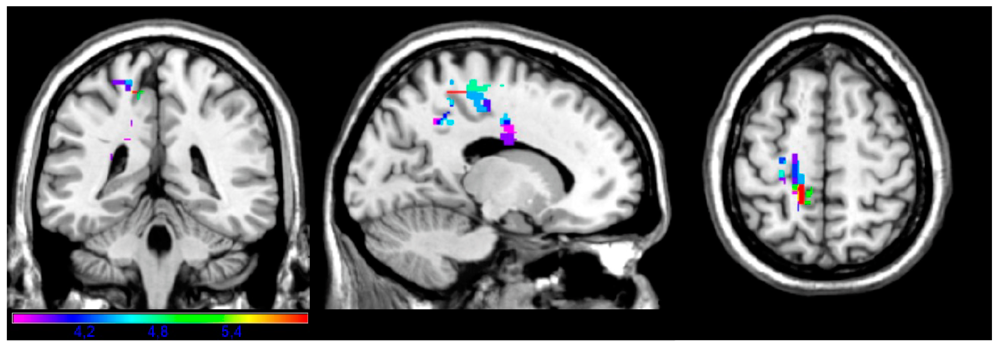 Brainsci 14 00853 g003