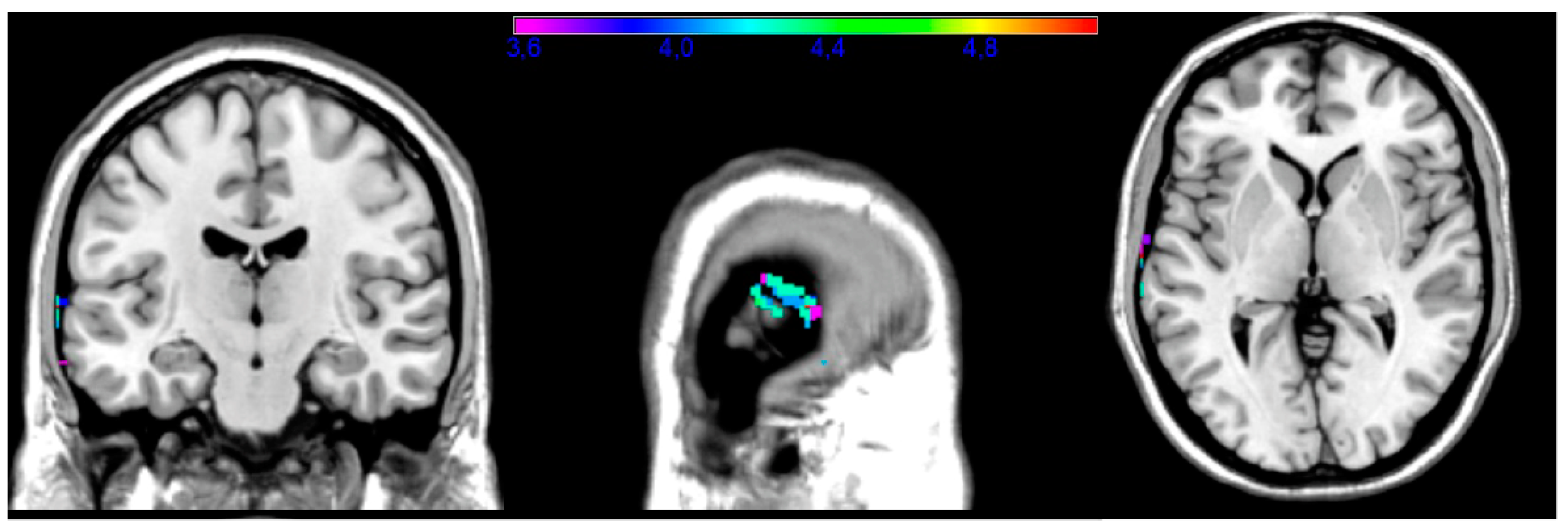 Brainsci 14 00853 g005