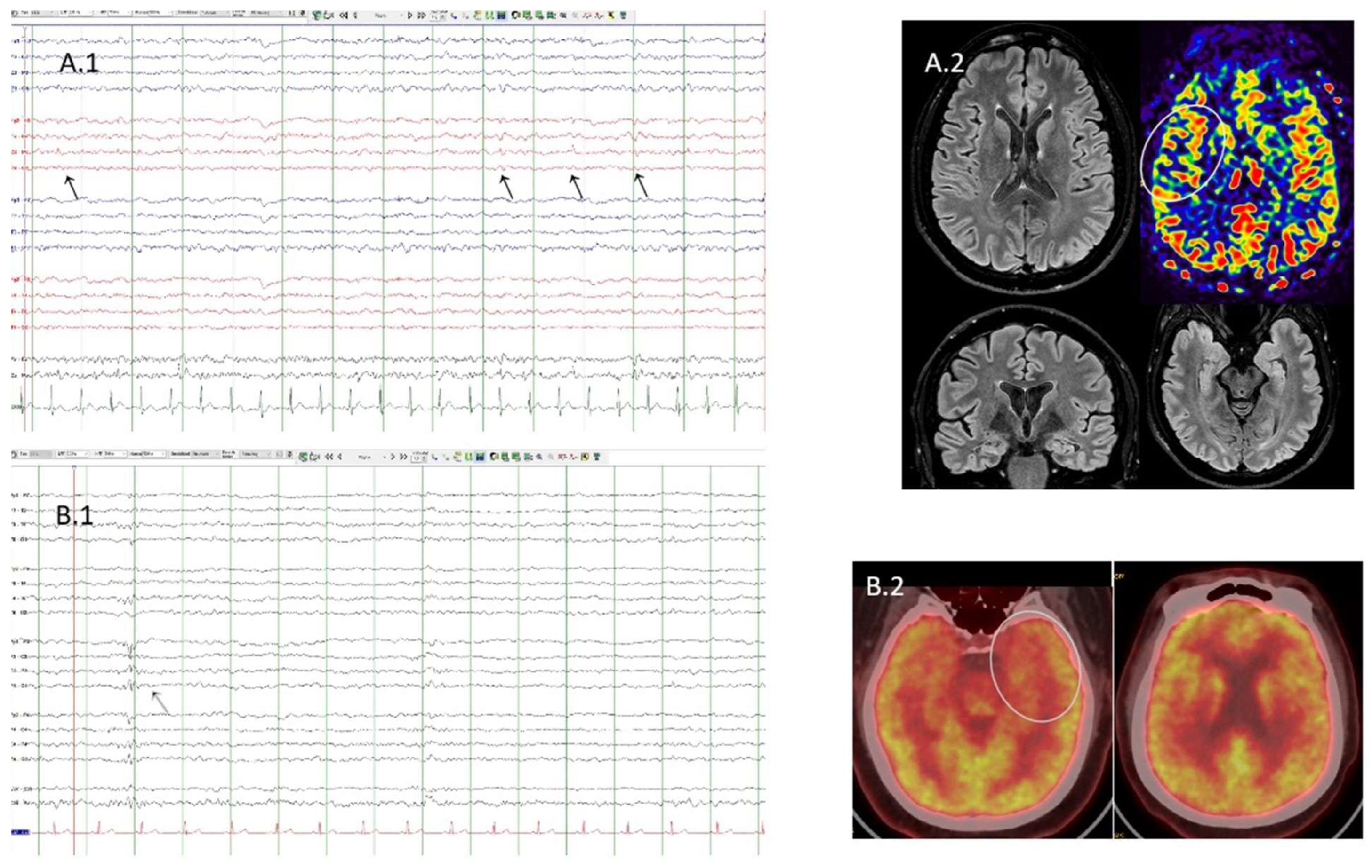 Brainsci 14 00870 g001