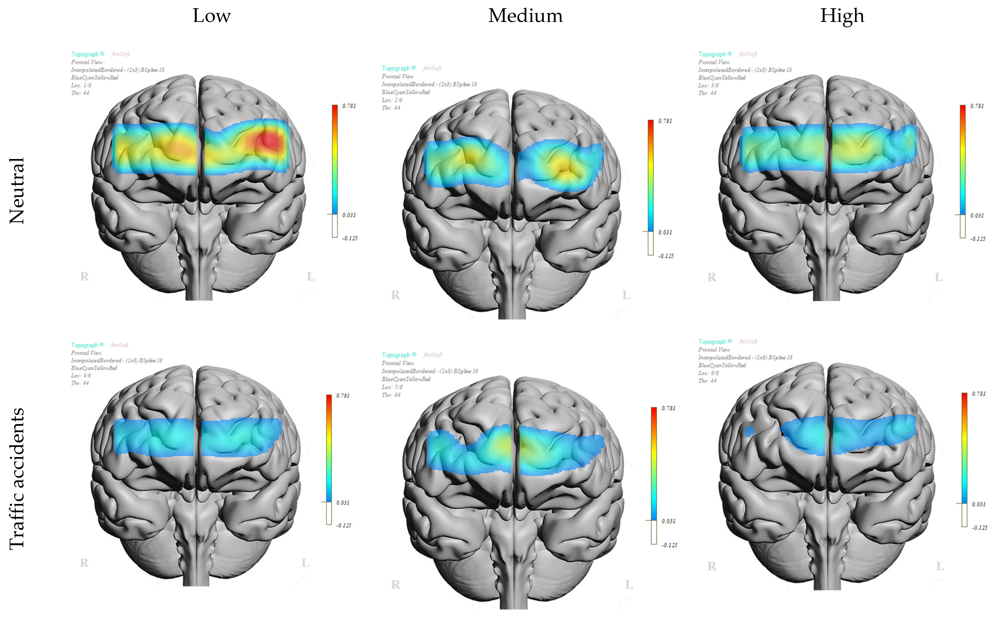 Brainsci 14 00884 g004