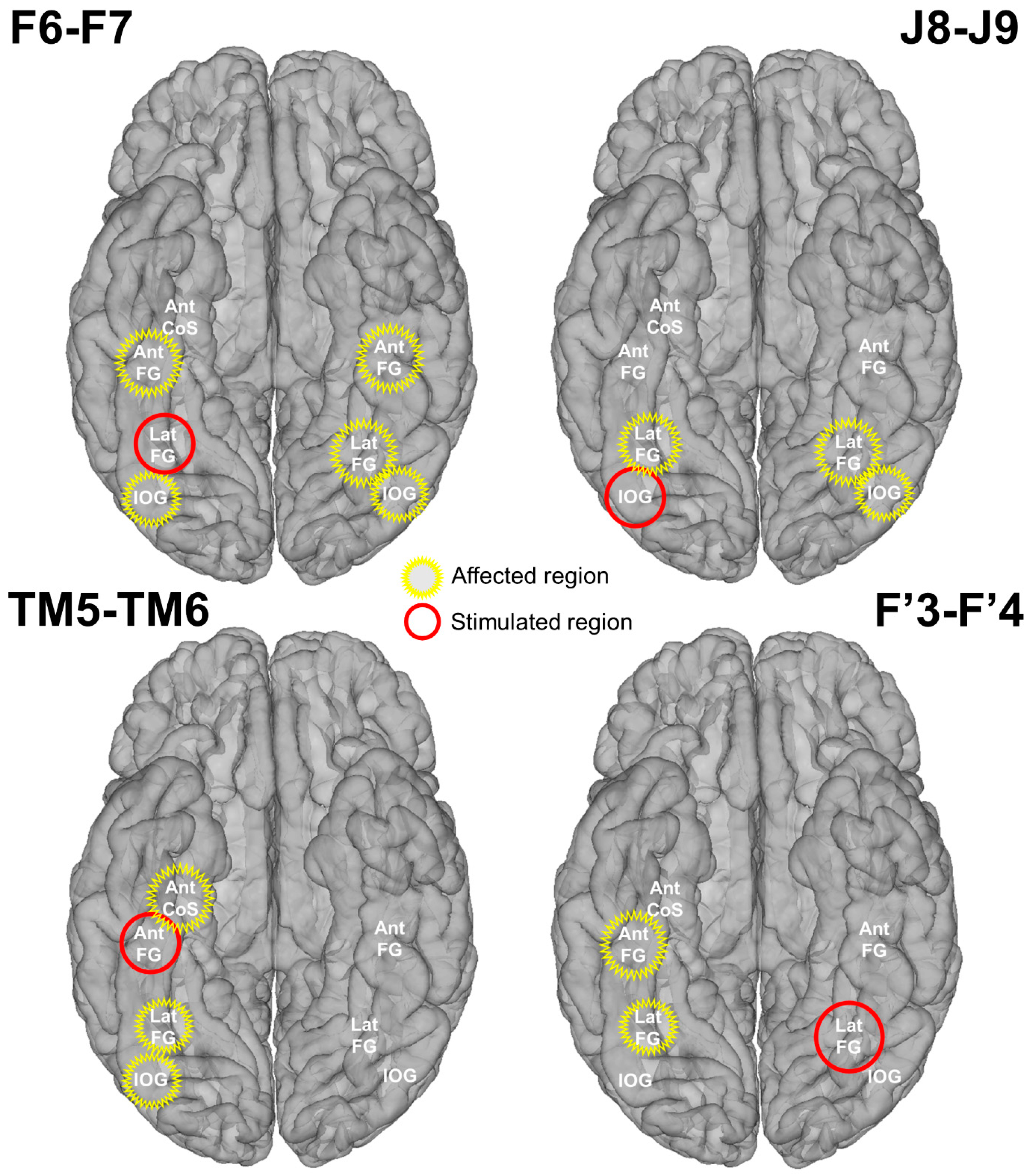 Brainsci 14 00906 g005