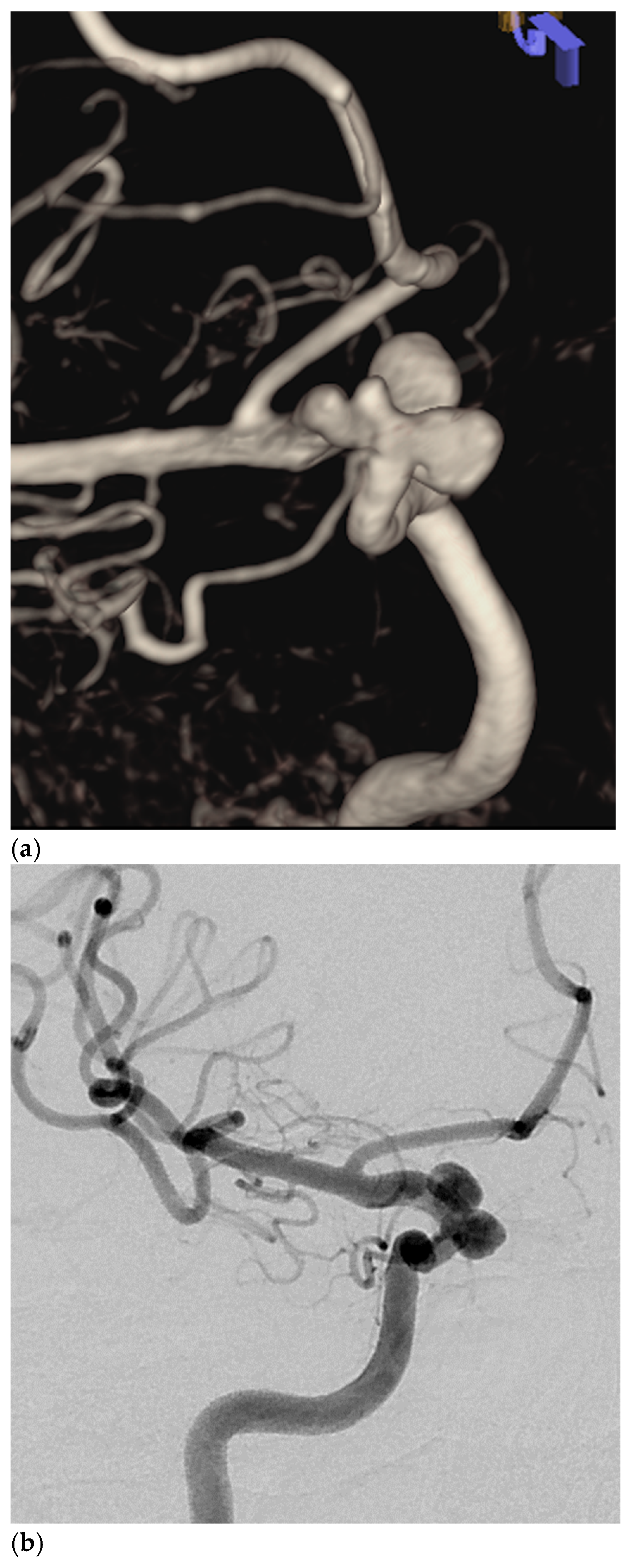 Brainsci 14 00911 g001a