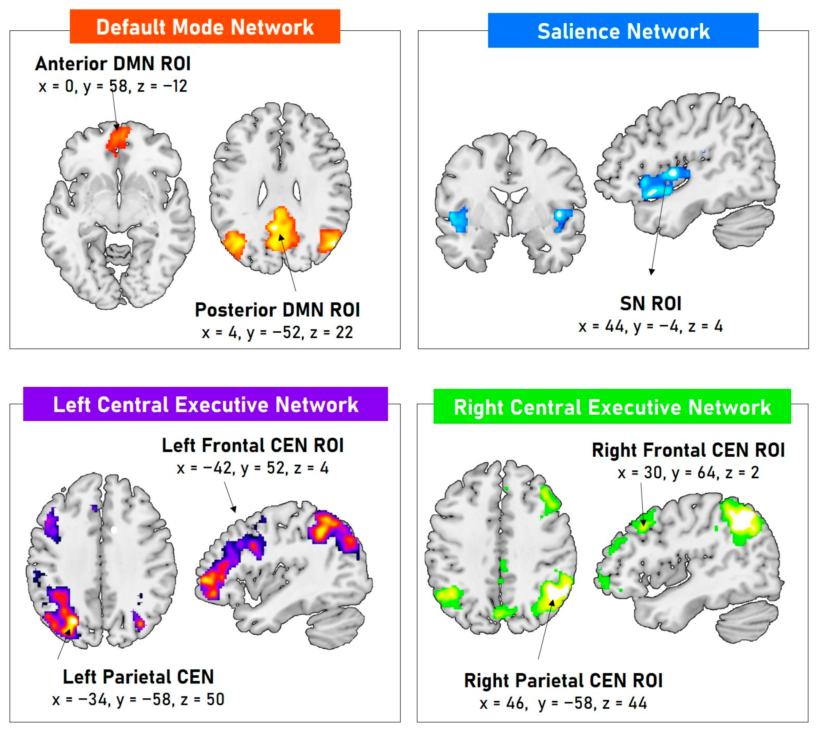 Brainsci 14 00913 g001