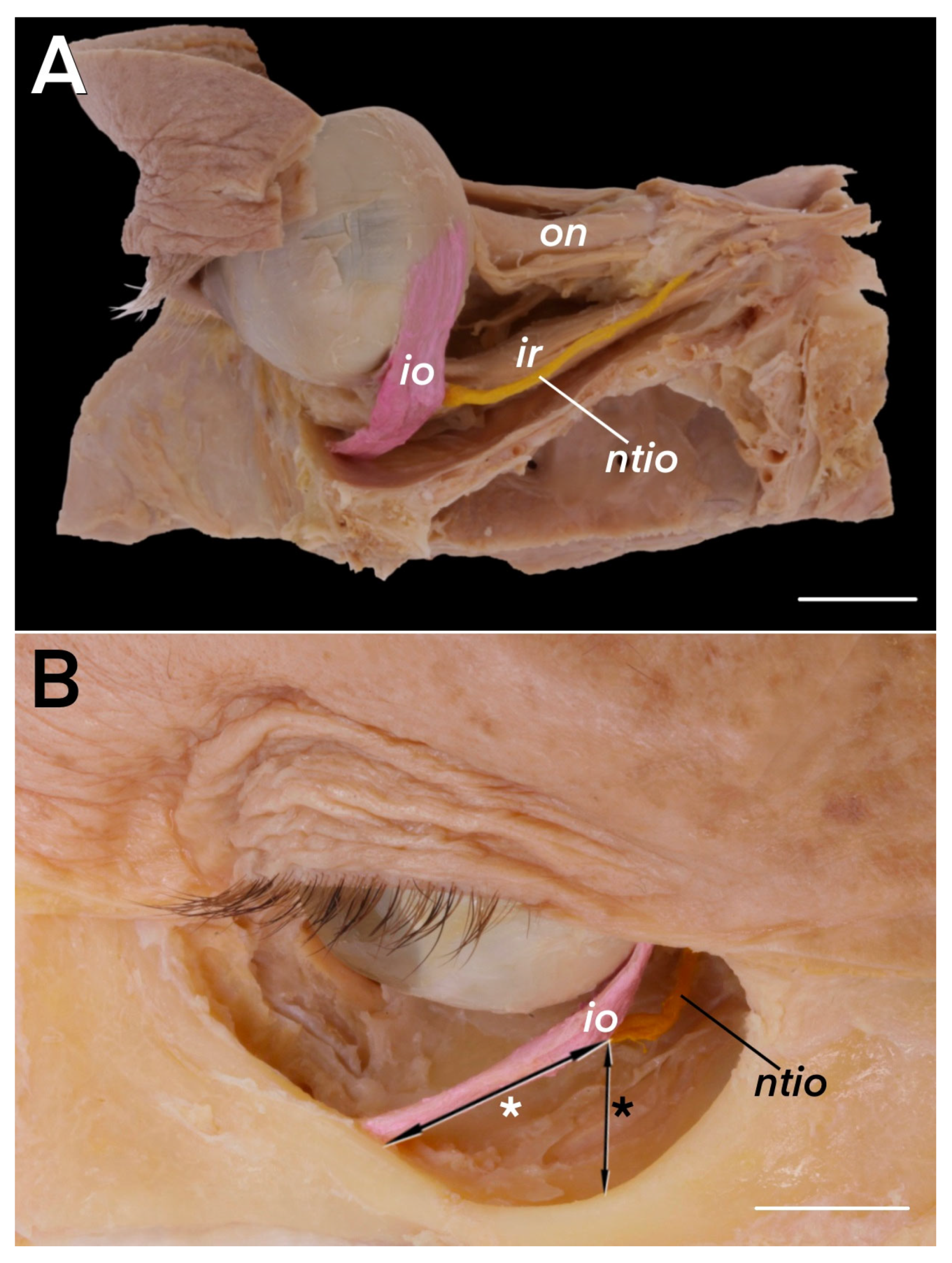 Brainsci 14 00925 g001