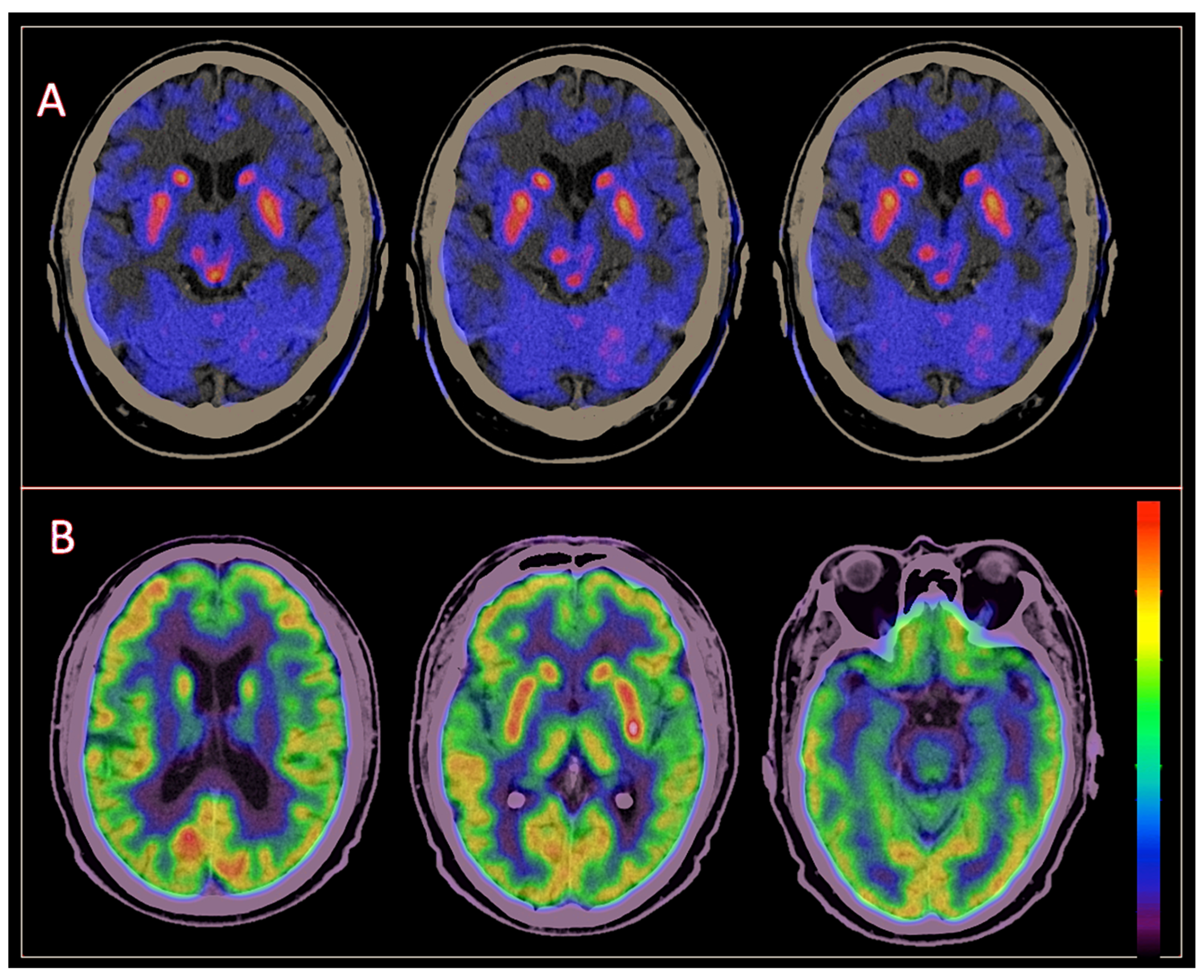 Brainsci 14 00930 g004