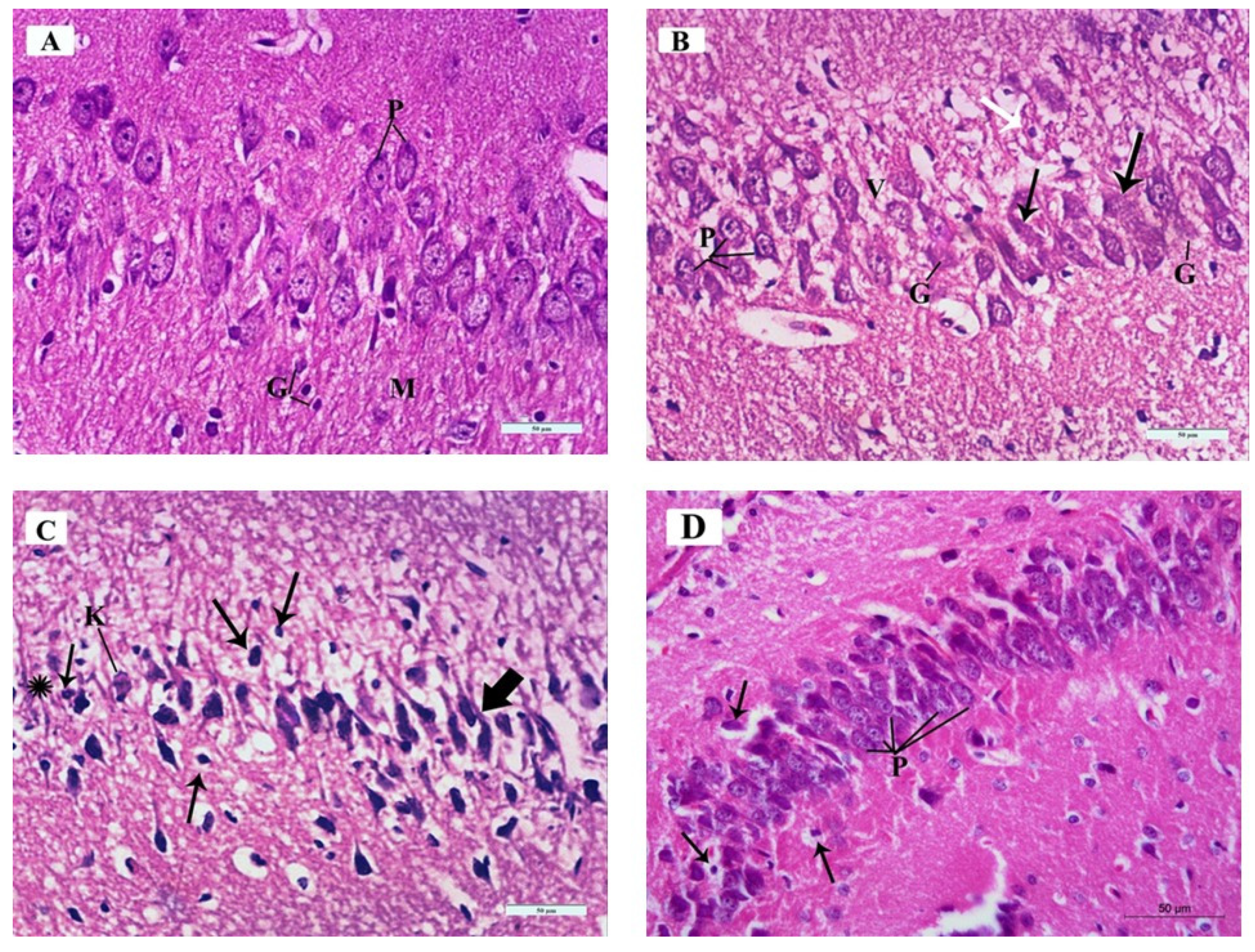 Brainsci 14 00933 g006