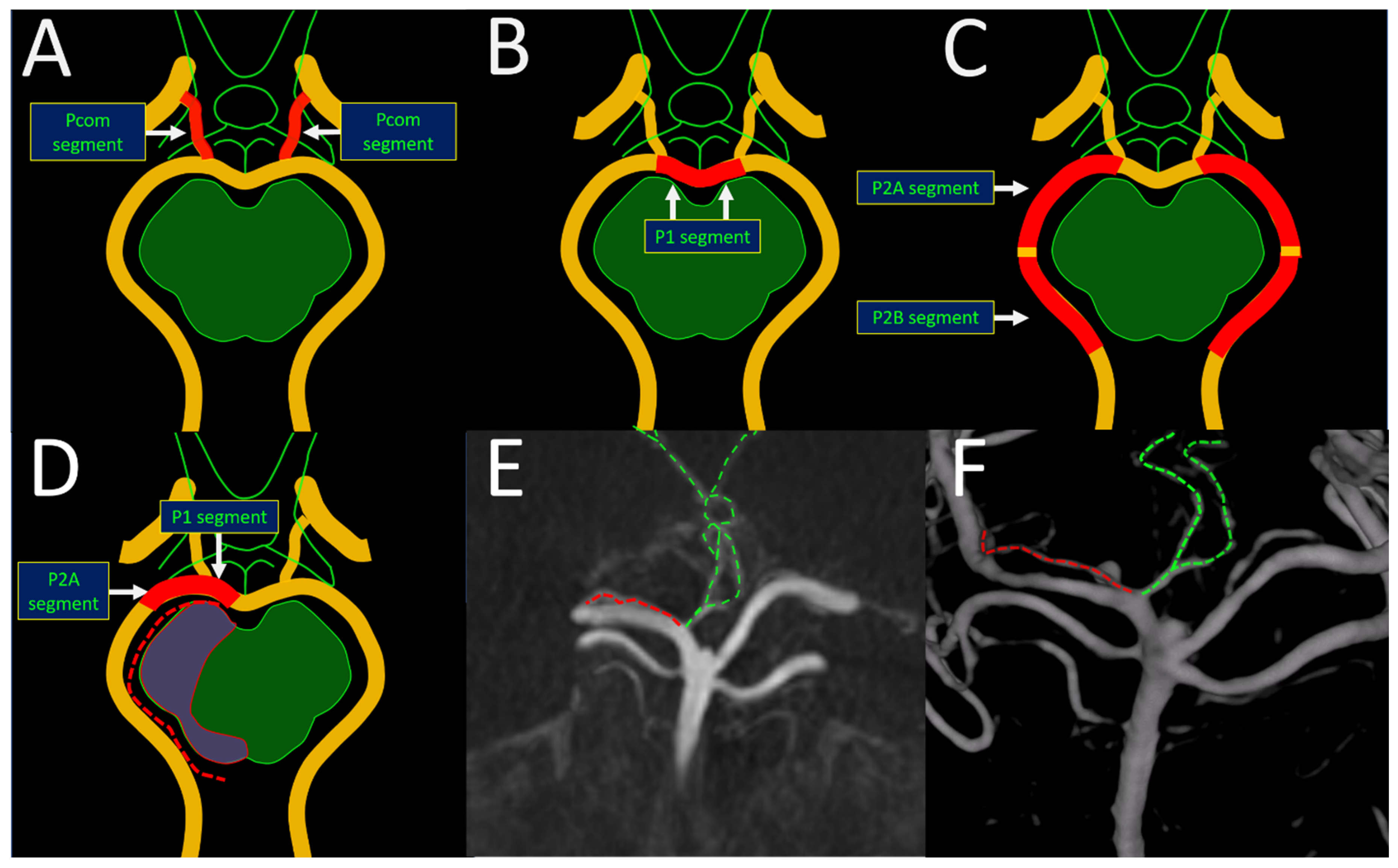 Brainsci 14 00934 g001 Brainsci 14 00934 g001