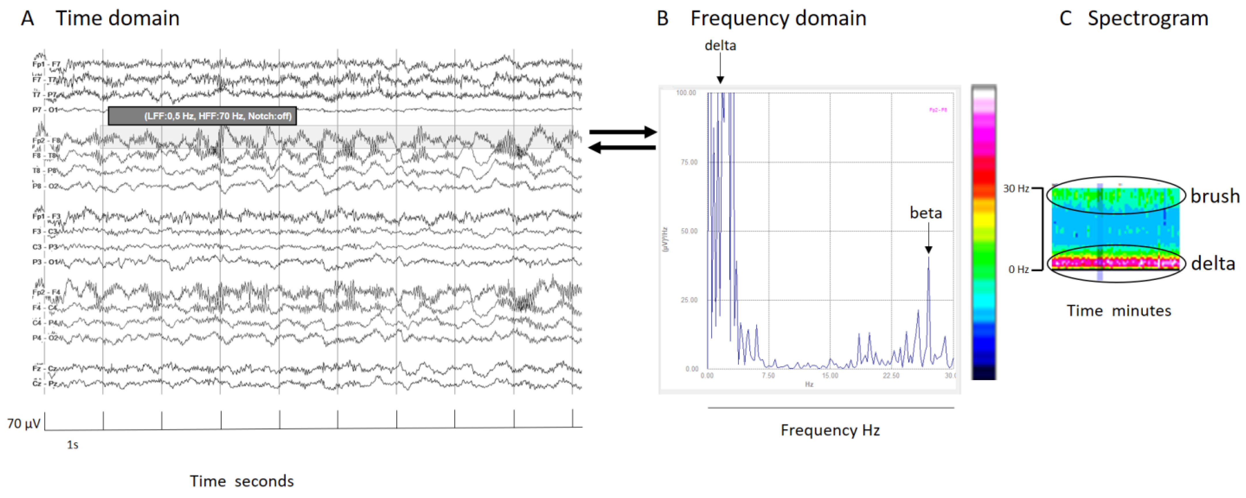 Brainsci 14 00939 g003