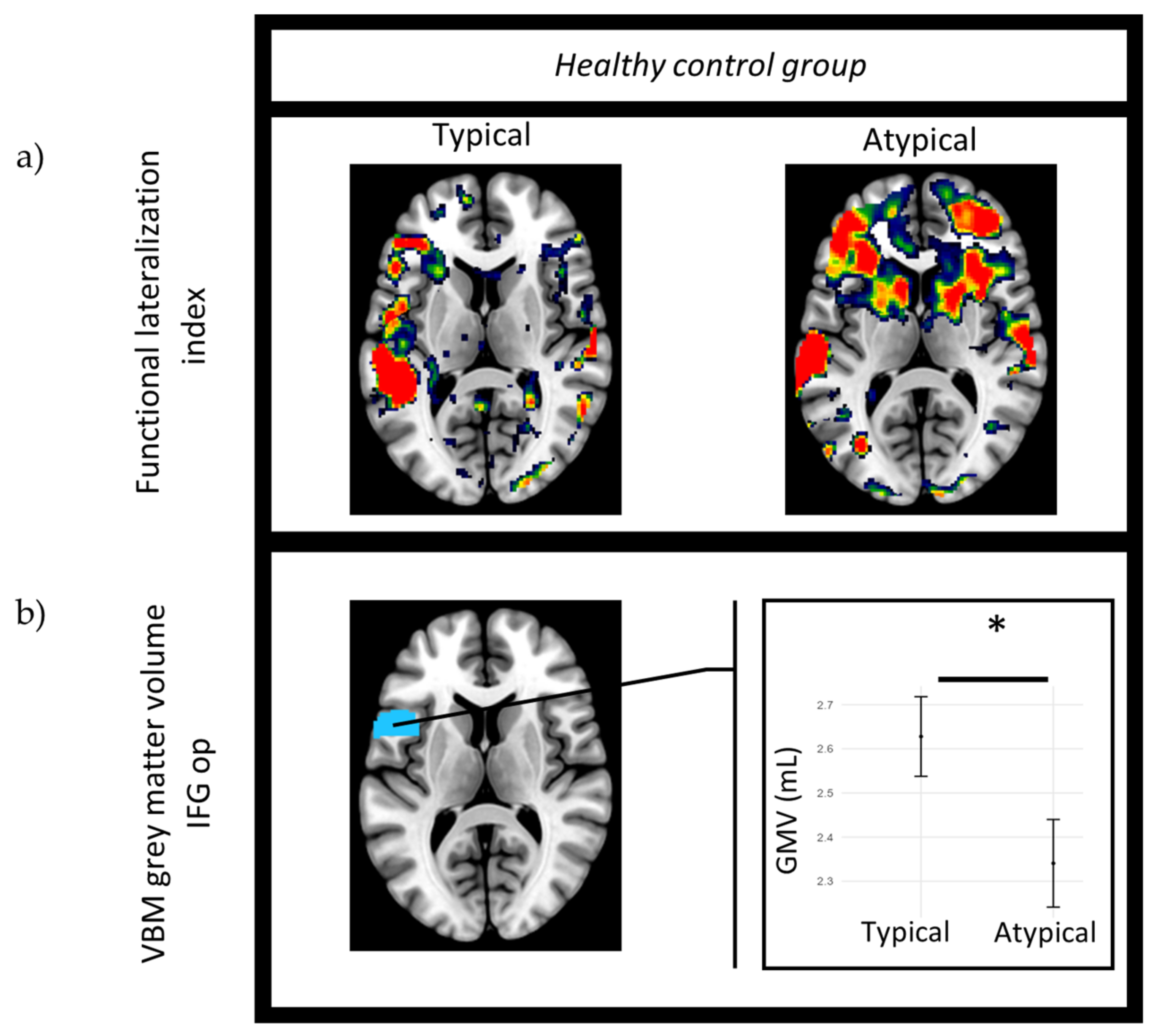 Brainsci 14 00954 g003 Brainsci 14 00954 g003