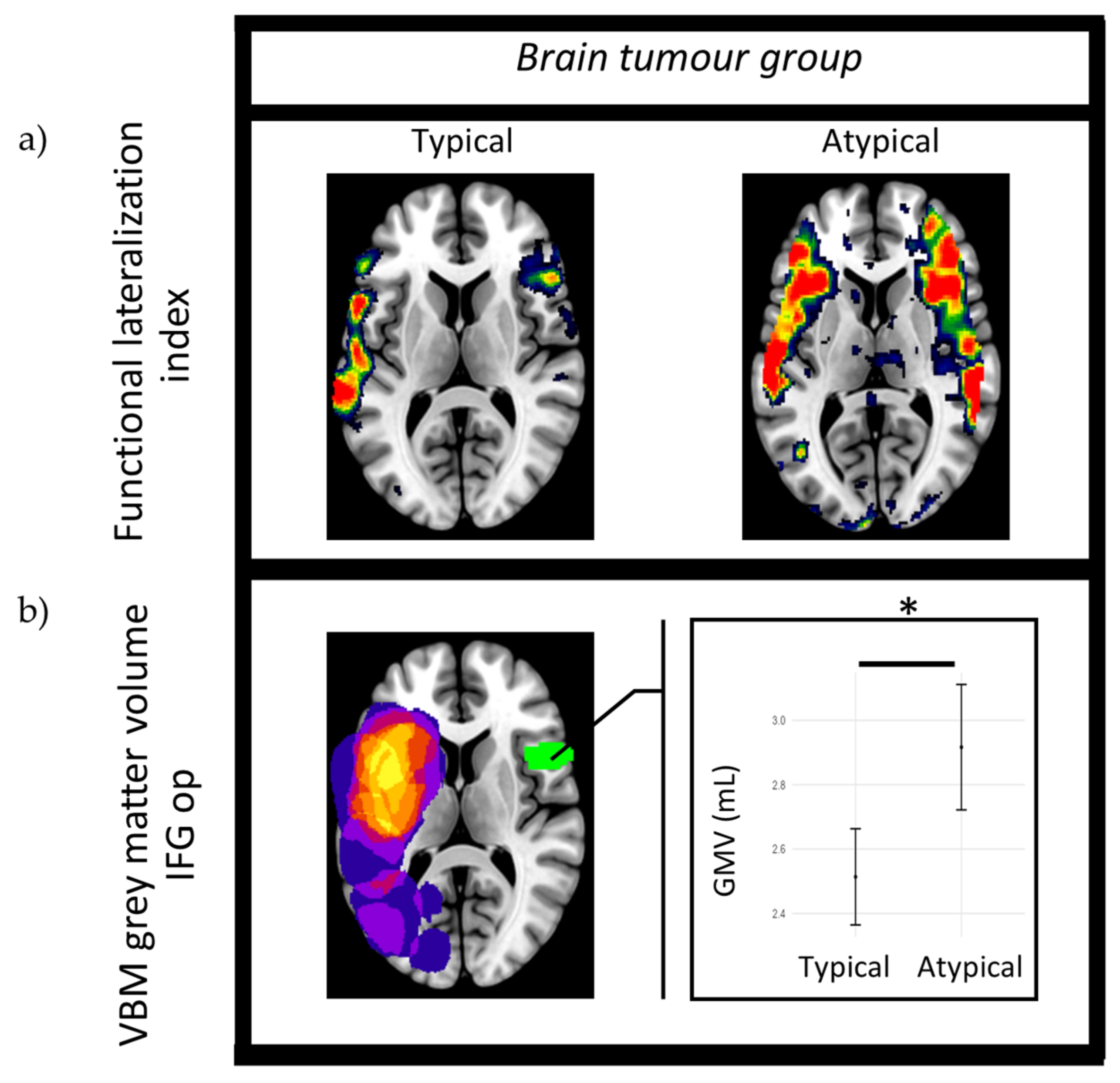 Brainsci 14 00954 g004 Brainsci 14 00954 g004