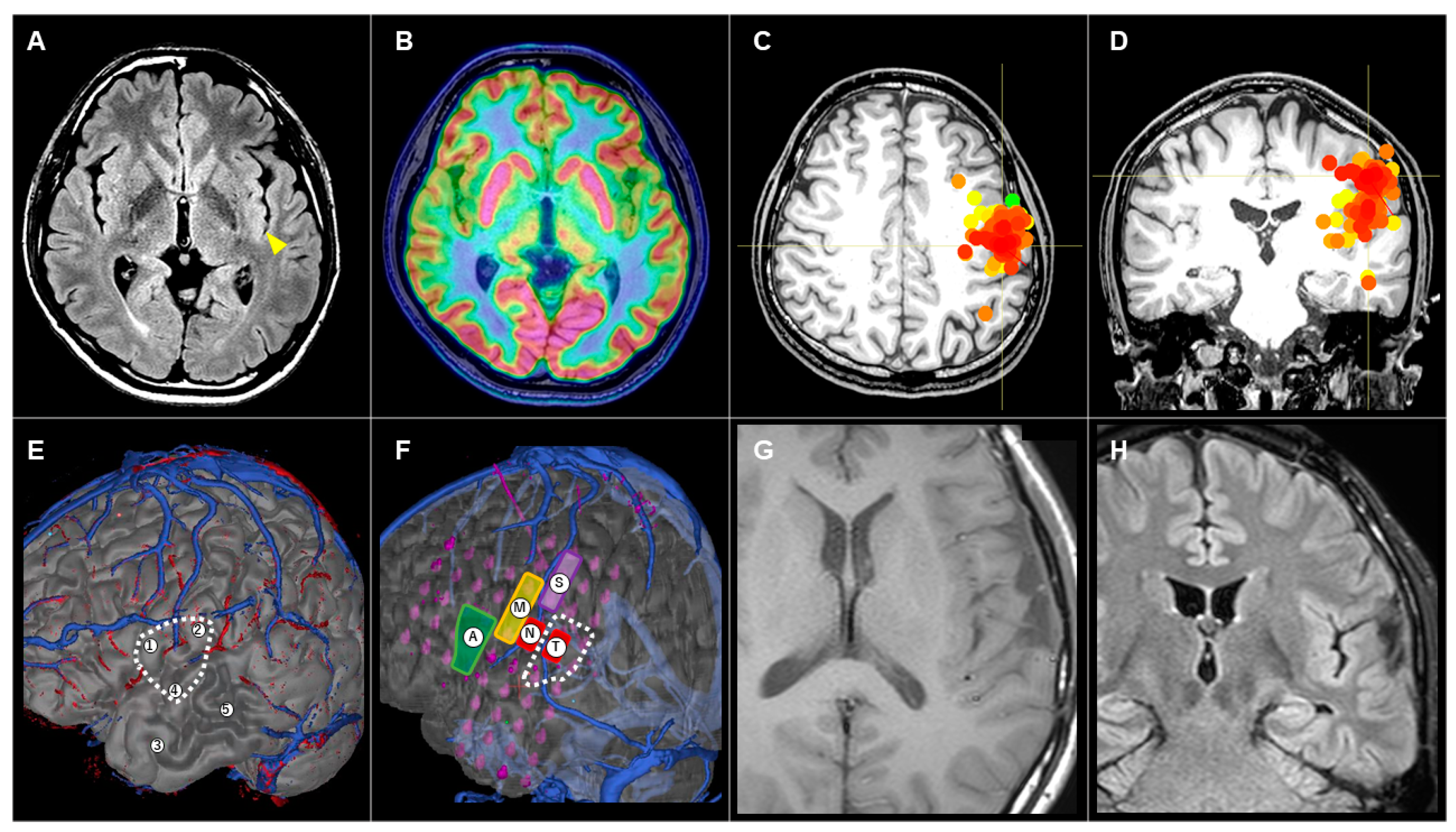 Brainsci 14 00958 g004