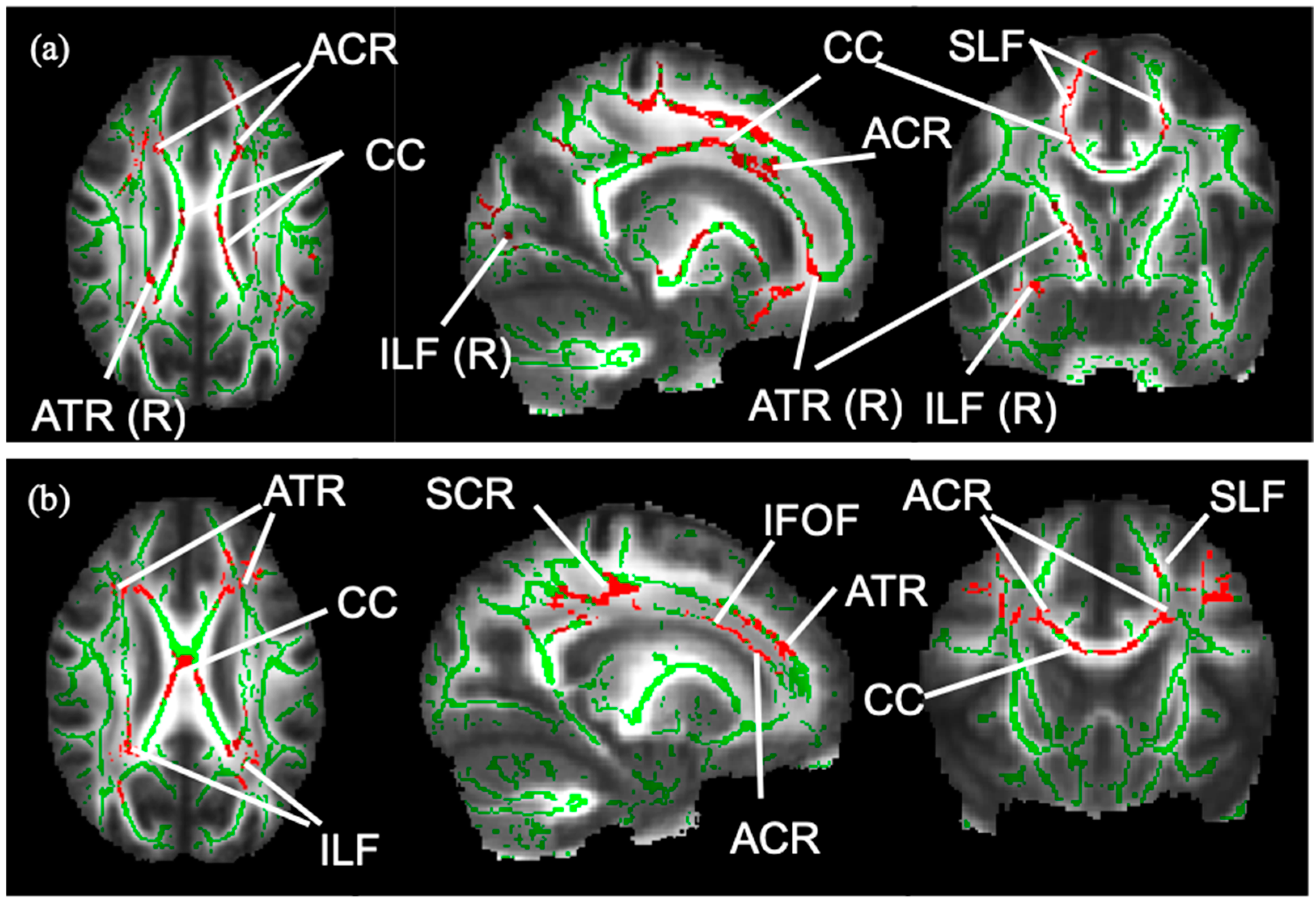 Brainsci 14 00975 g001