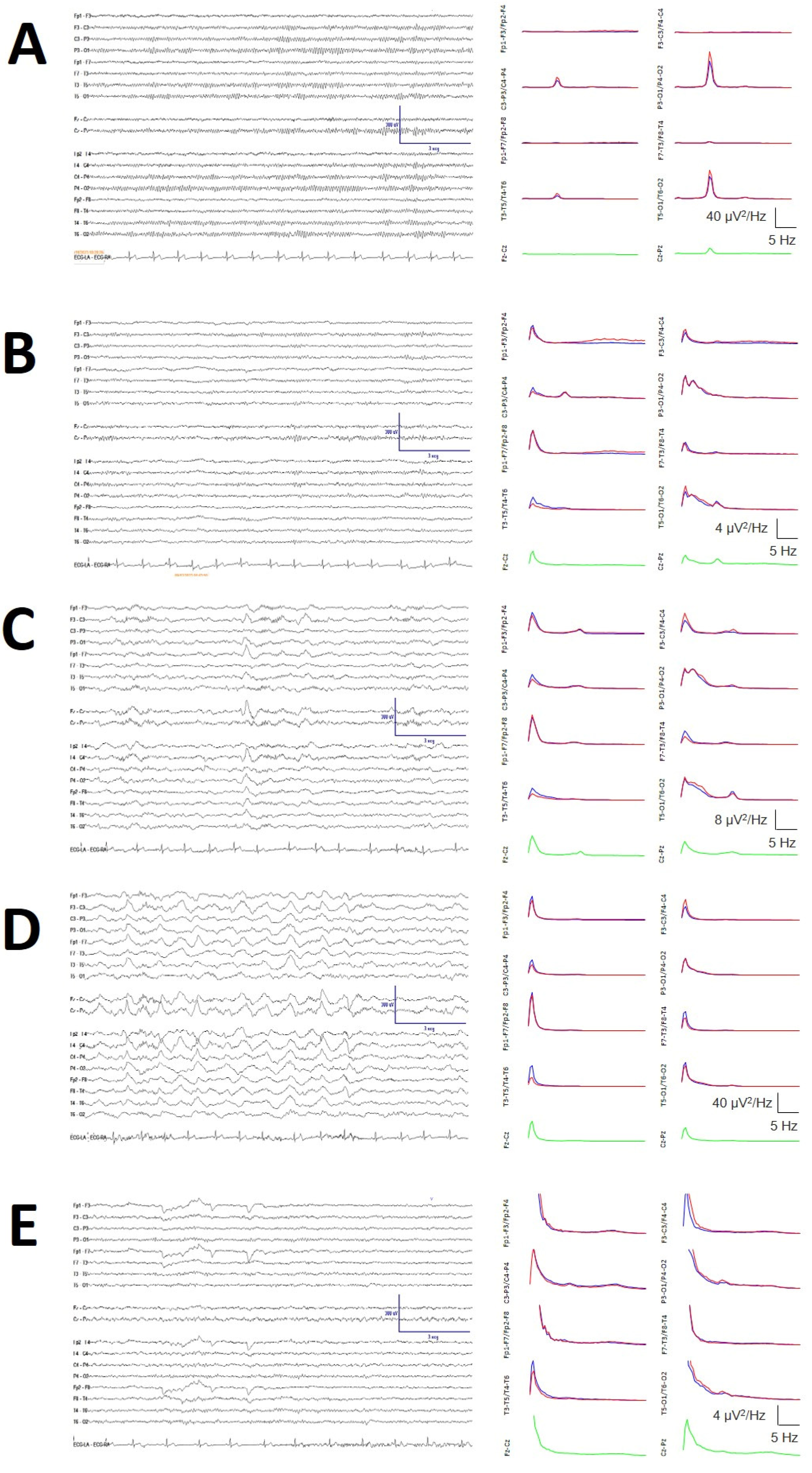 Brainsci 14 01007 g0a4