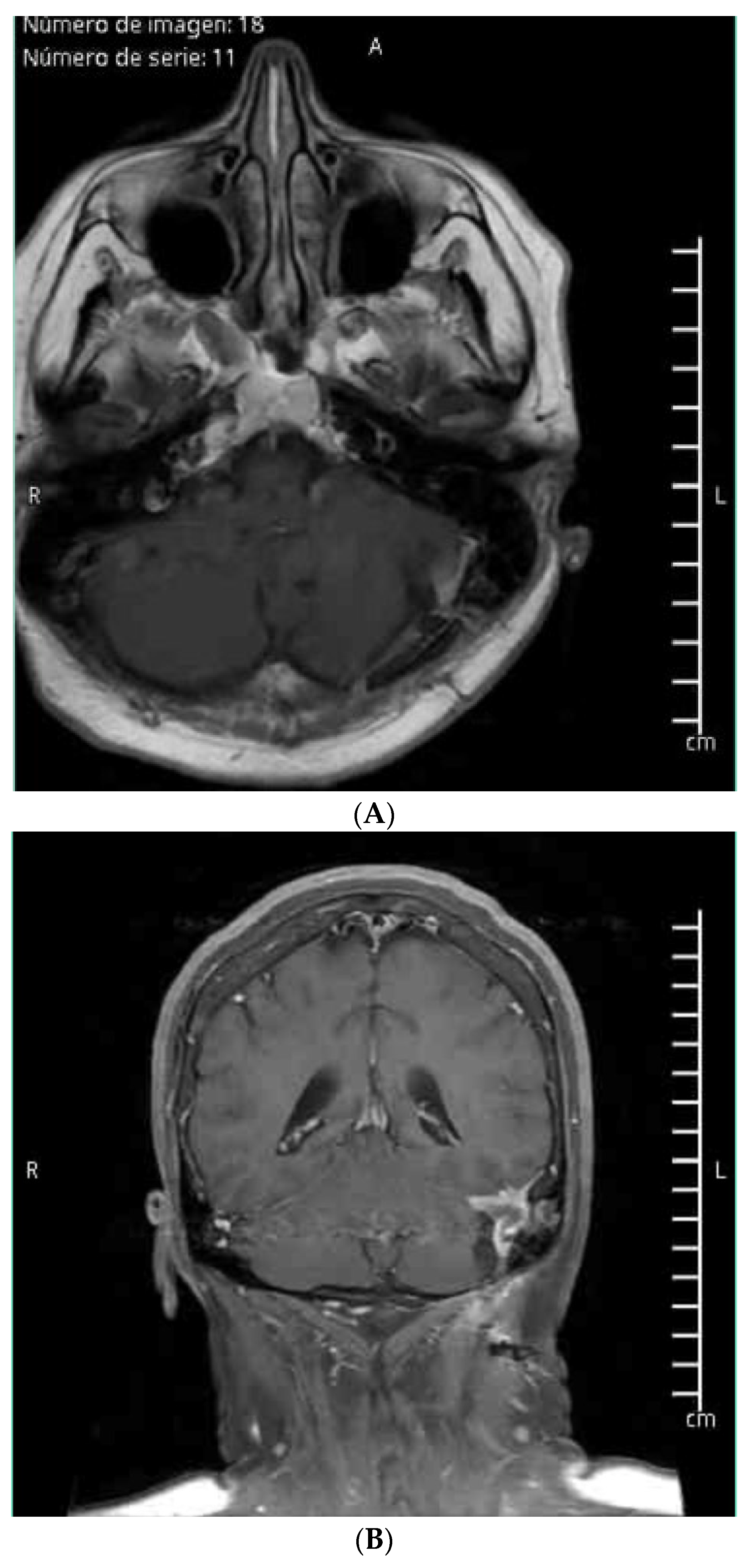 Brainsci 14 01025 g003