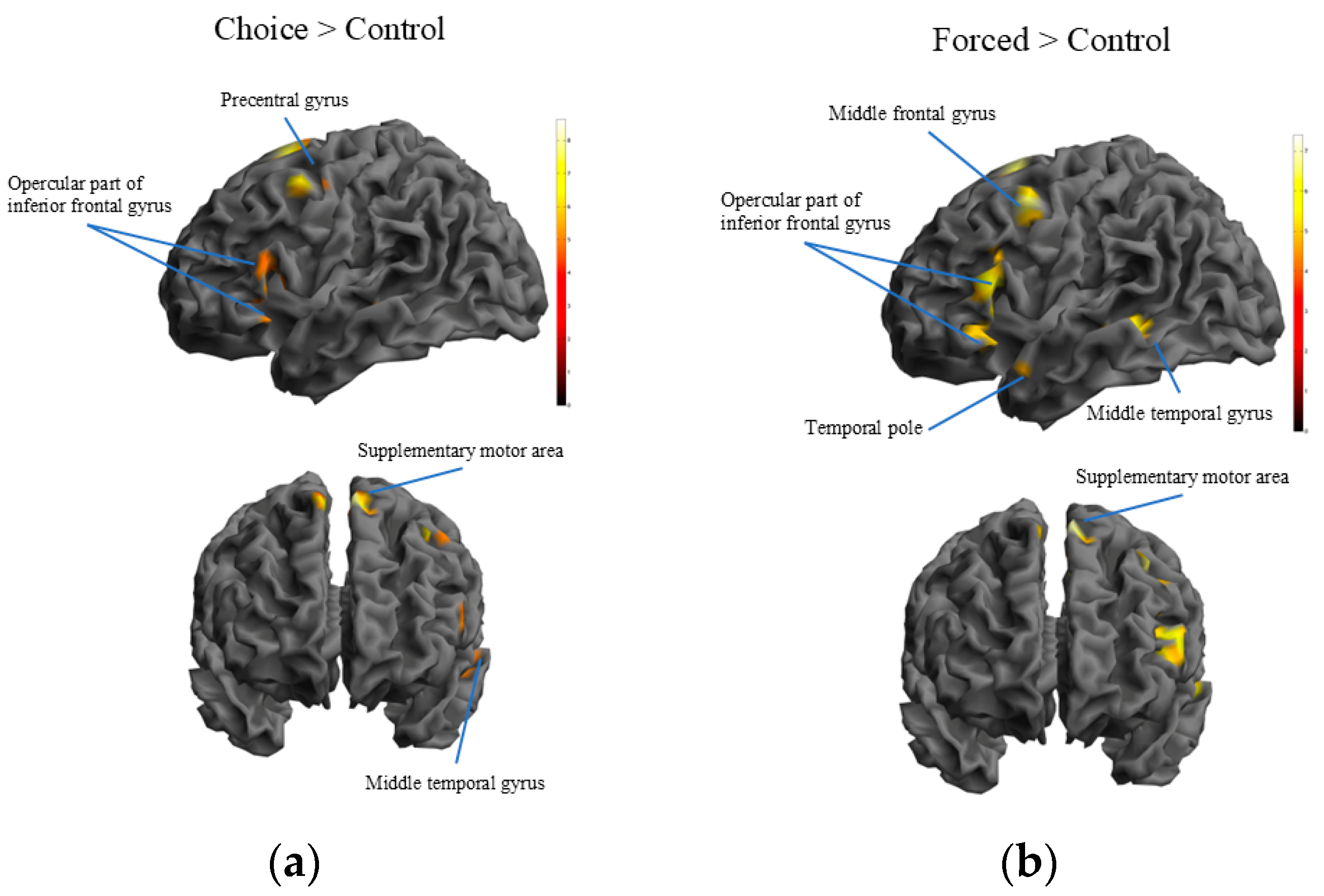 Brainsci 14 01077 g003