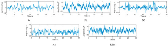 Single-Channel Sleep EEG Classification Method Based on LSTM and Hidden ...