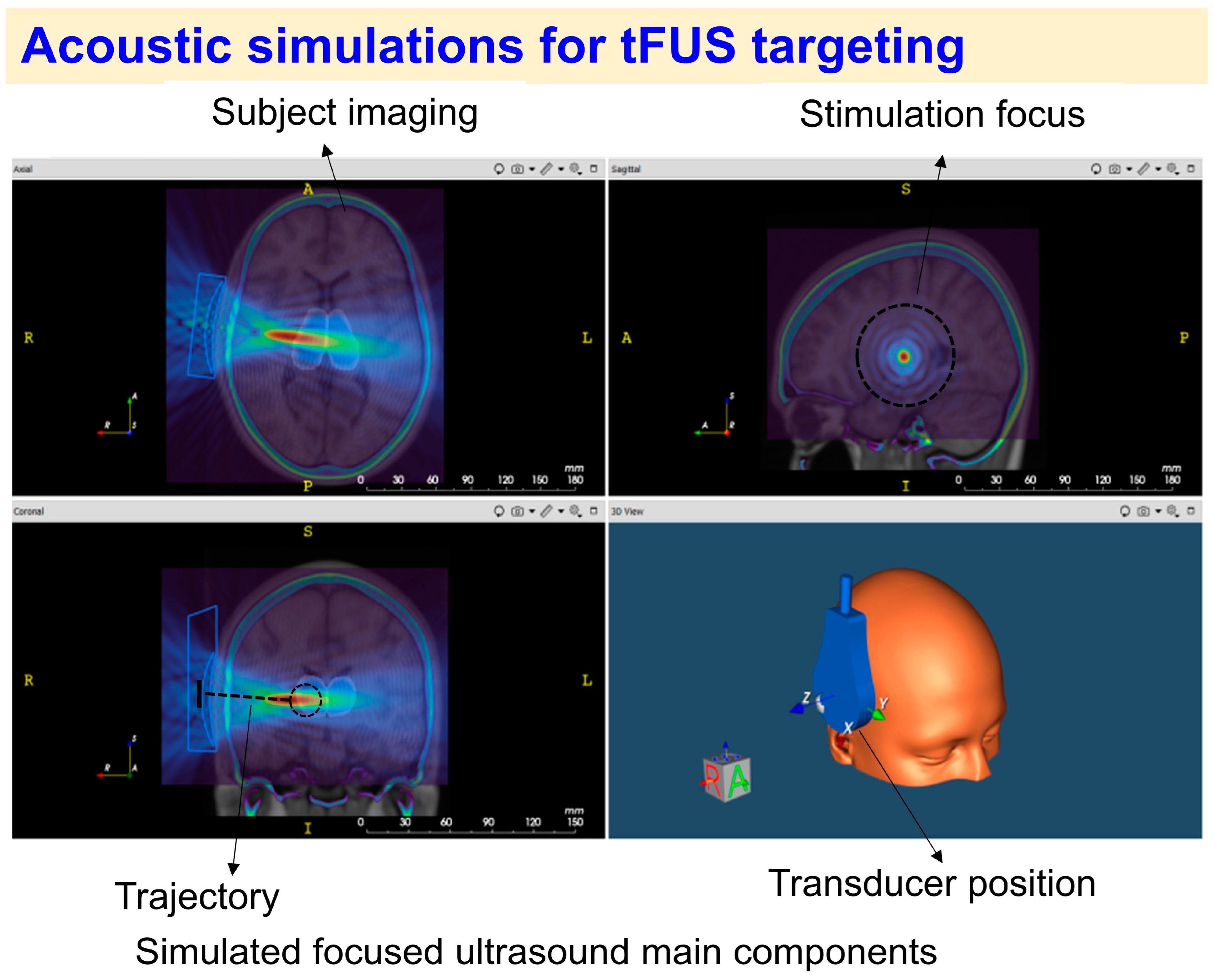 Brainsci 14 01095 g003