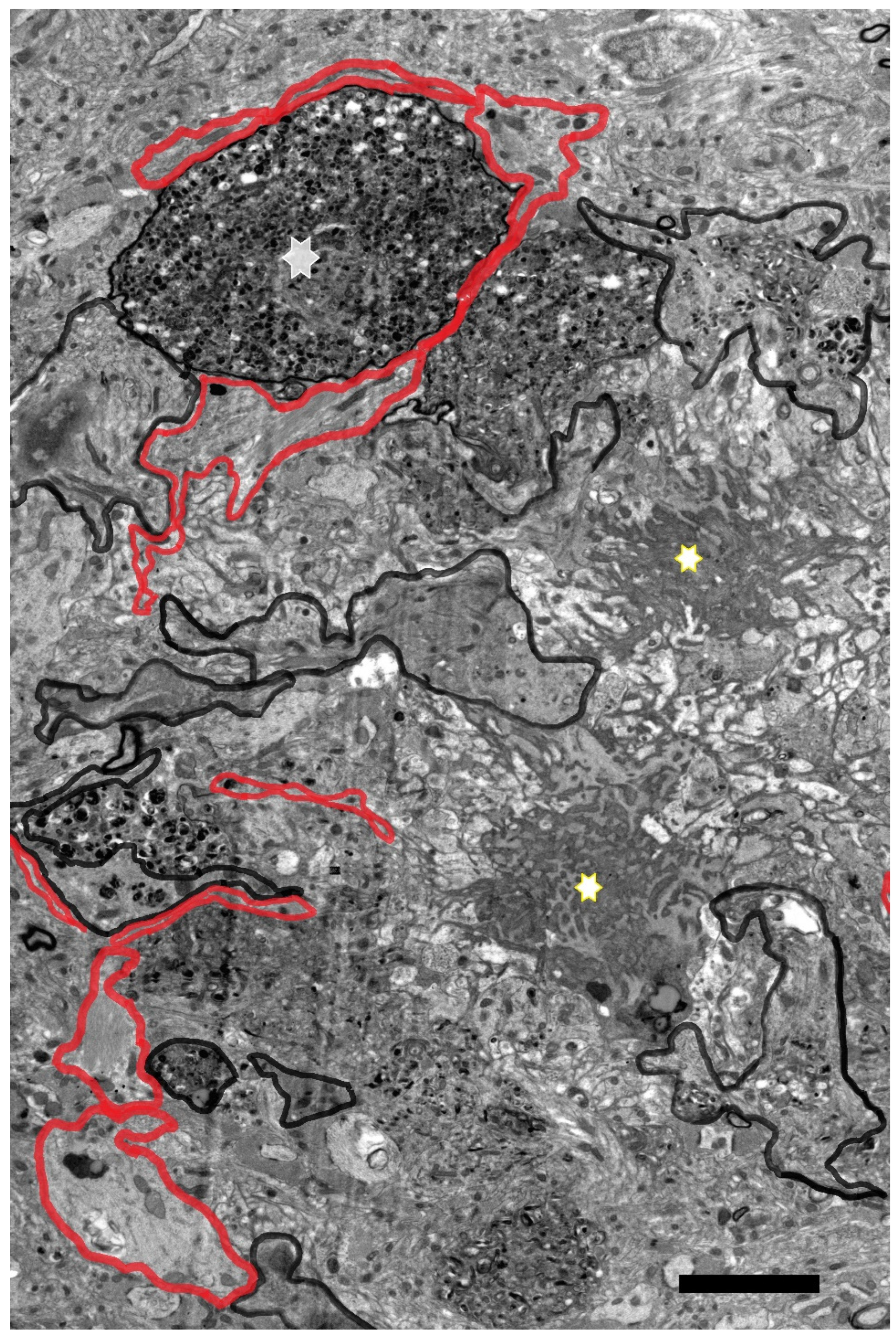 Brainsci 14 01101 g013