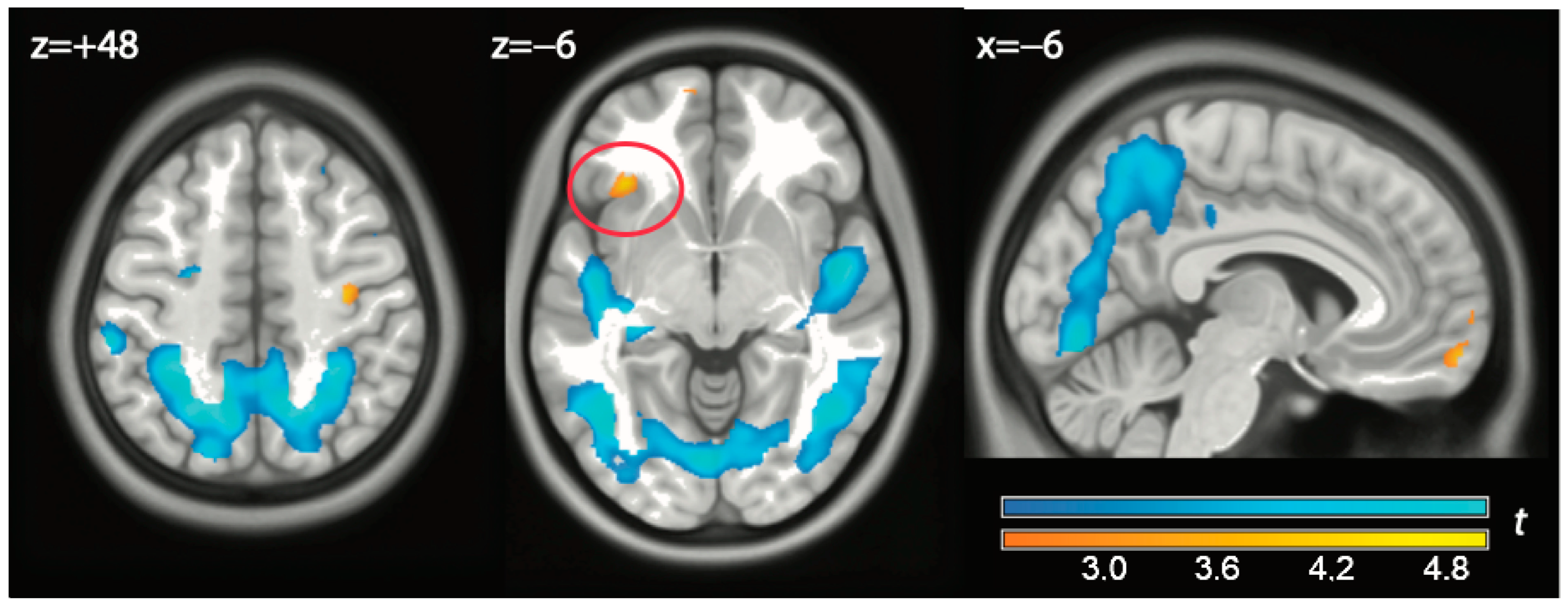 Brainsci 14 01158 g003
