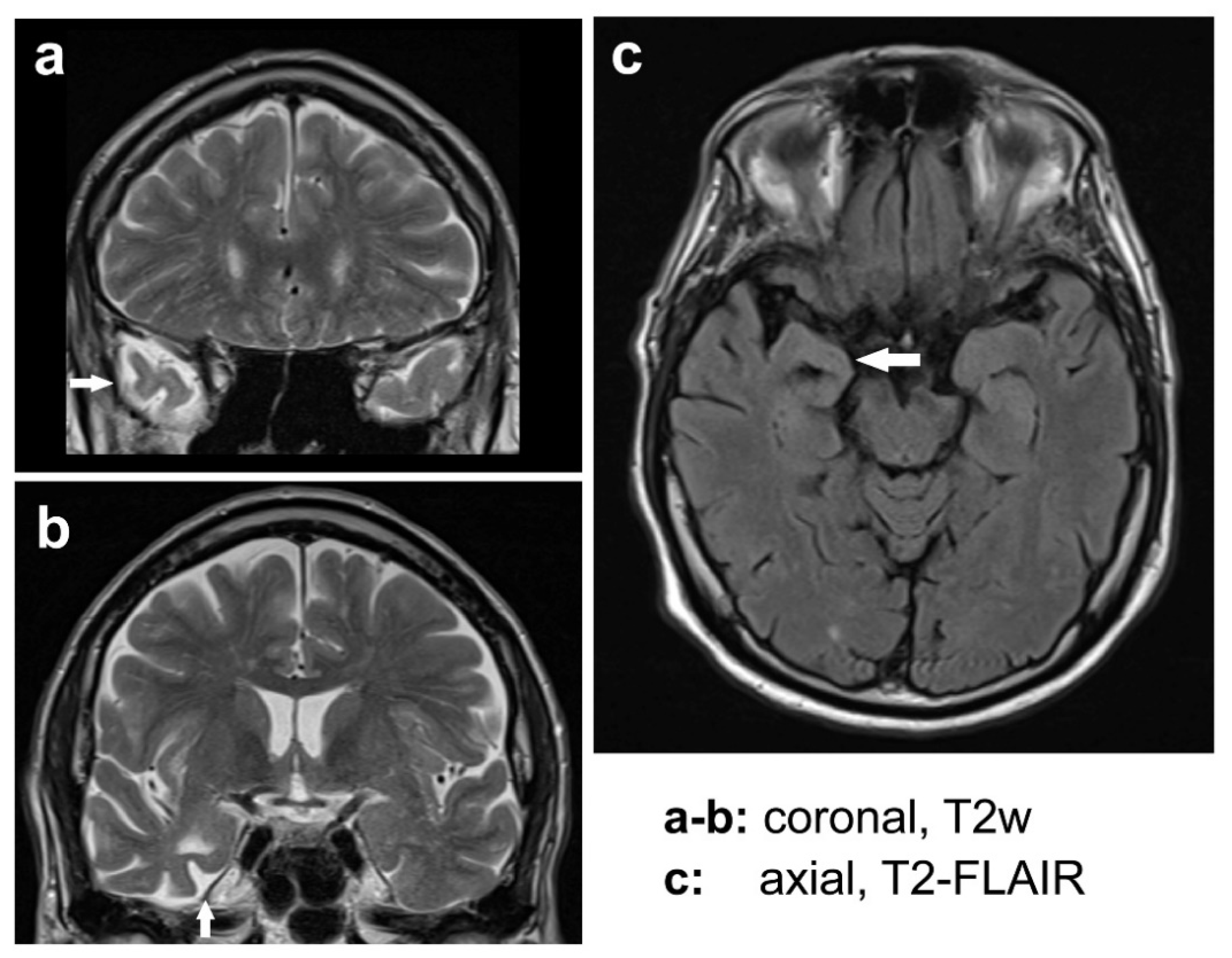 Brainsci 14 01171 g008 Brainsci 14 01171 g008