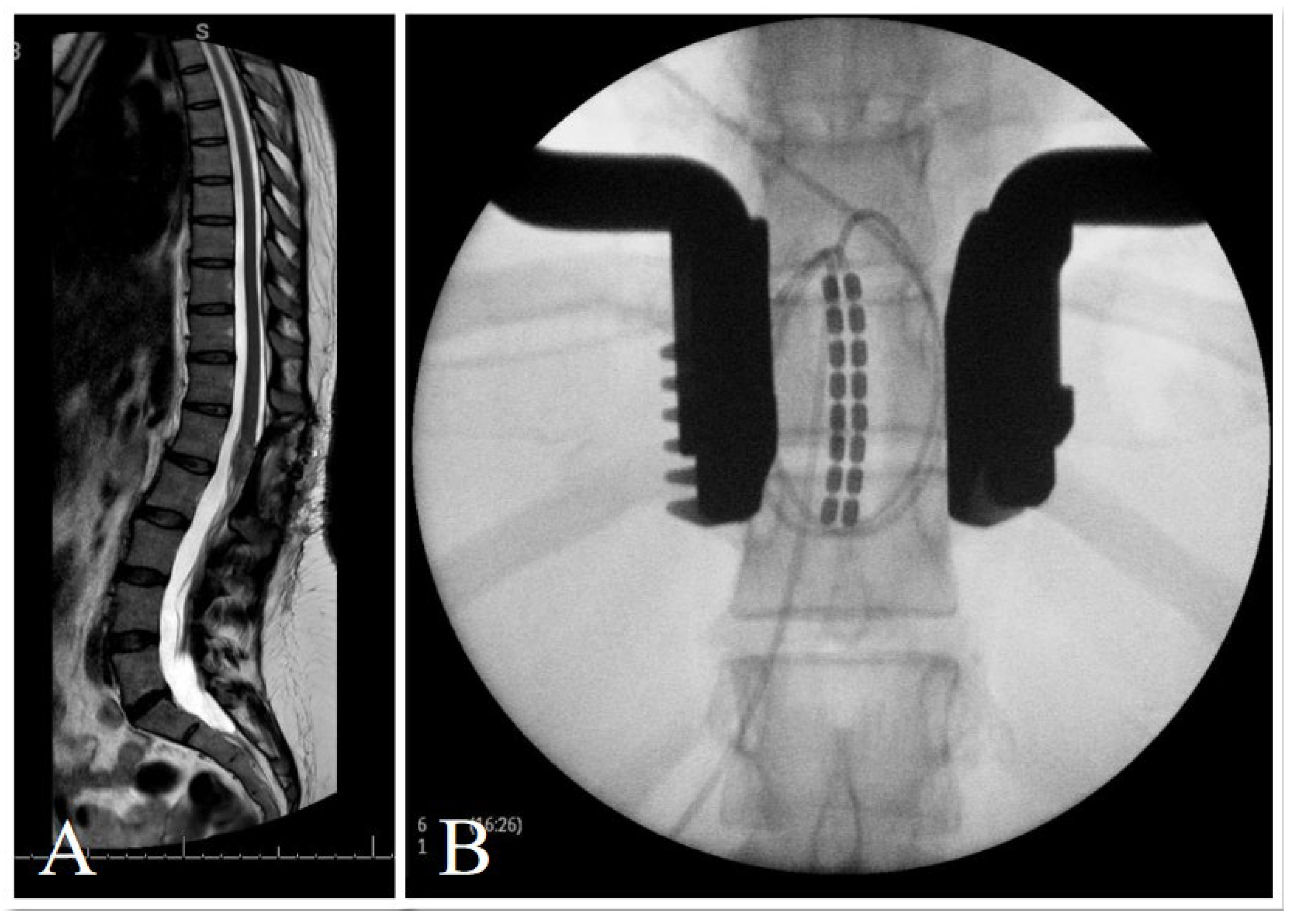 Brainsci 14 01173 g002