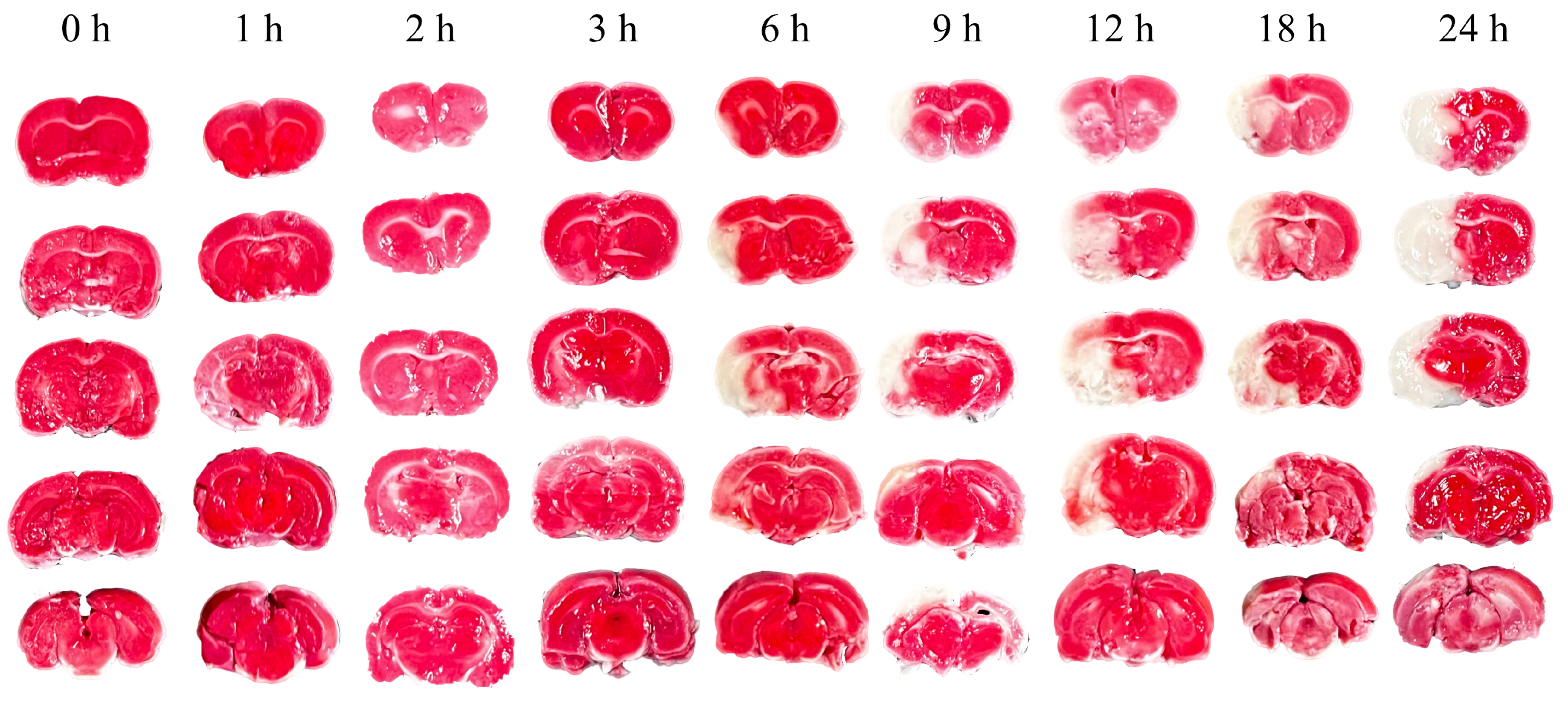Brainsci 14 01175 g003